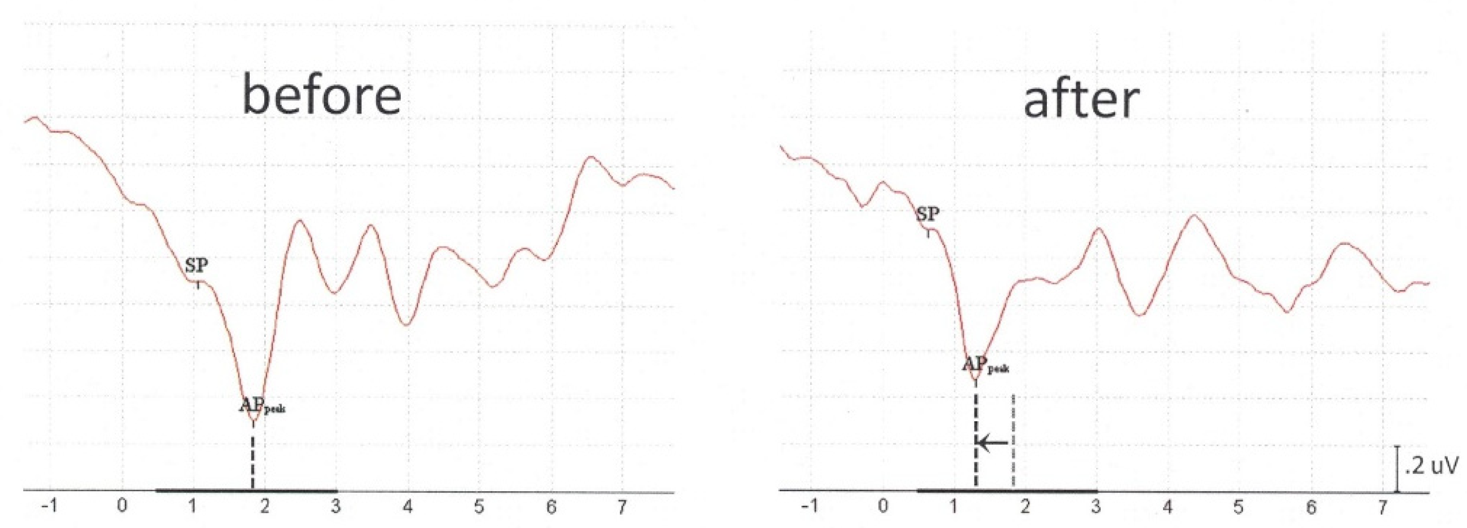Audiolres 11 00010 g0a1