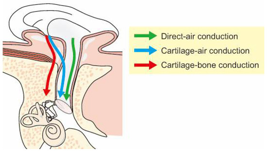 les differents chemins de la transmission par carthilage