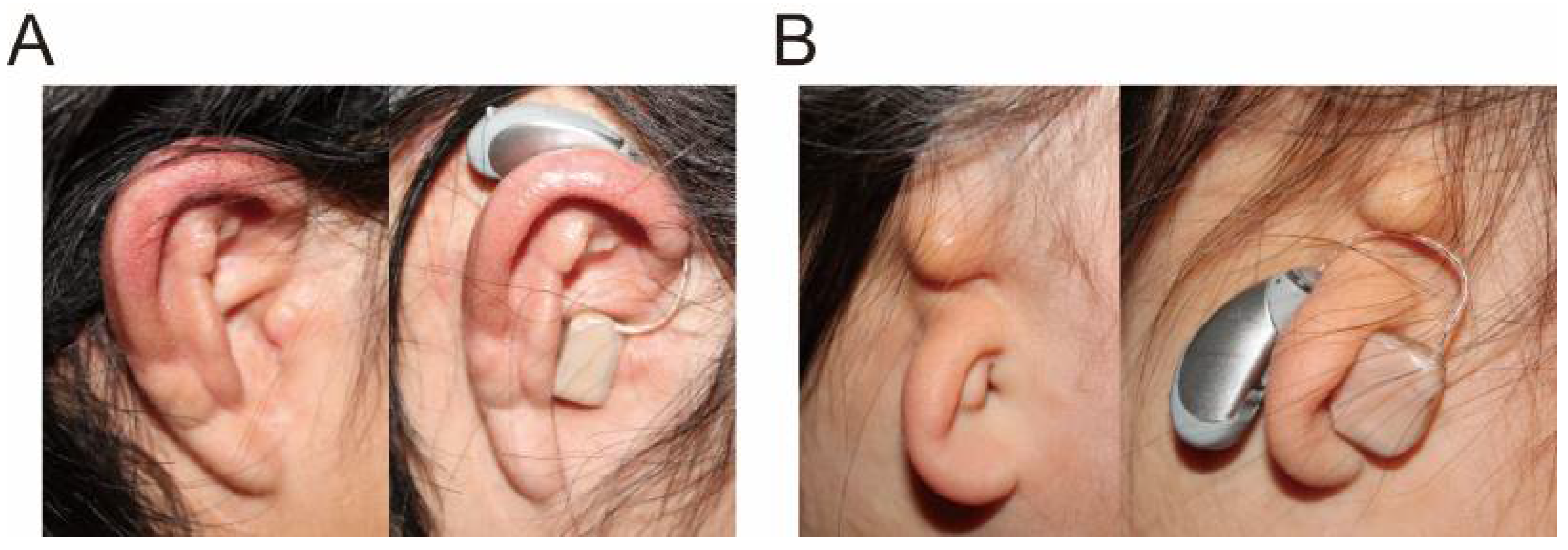 Audiolres 11 00023 g005 Audiolres 11 00023 g005