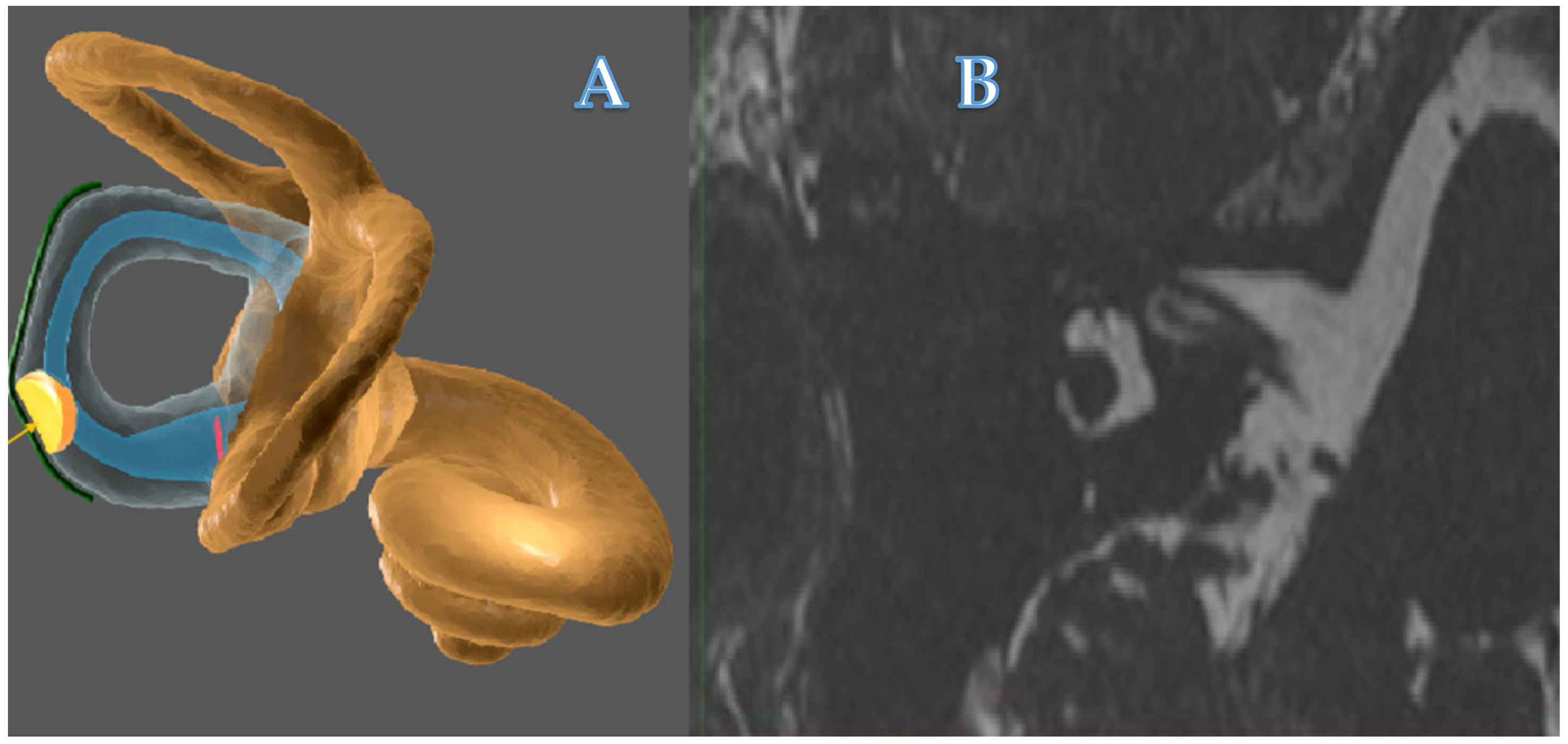 Audiolres 11 00028 g001 550