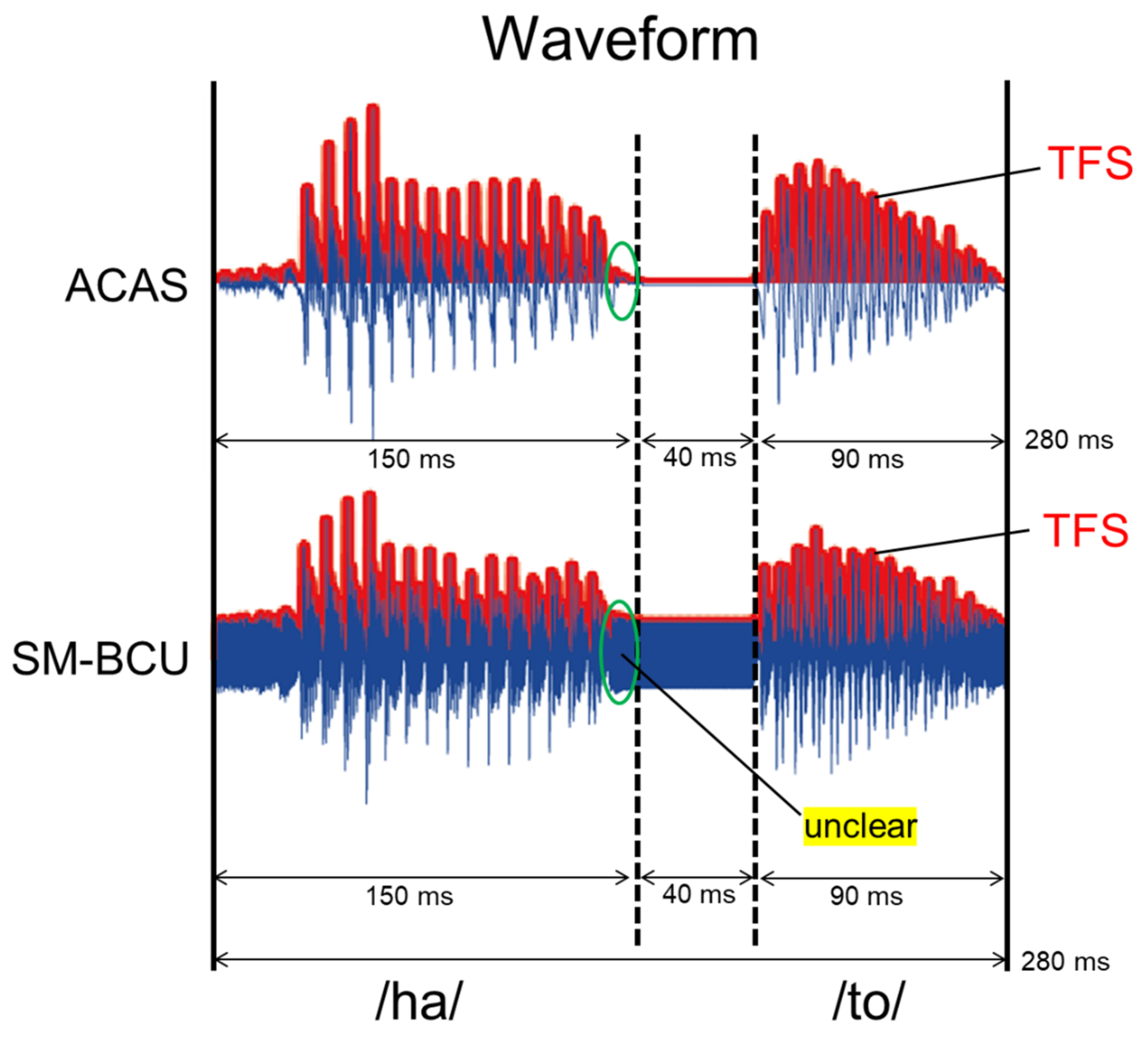 Audiolres 11 00033 g005 550