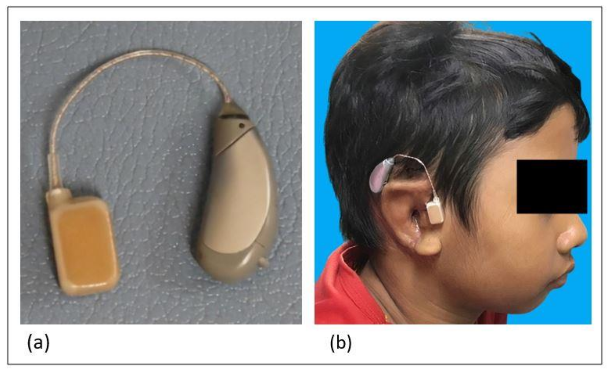 Audiolres 11 00038 g001