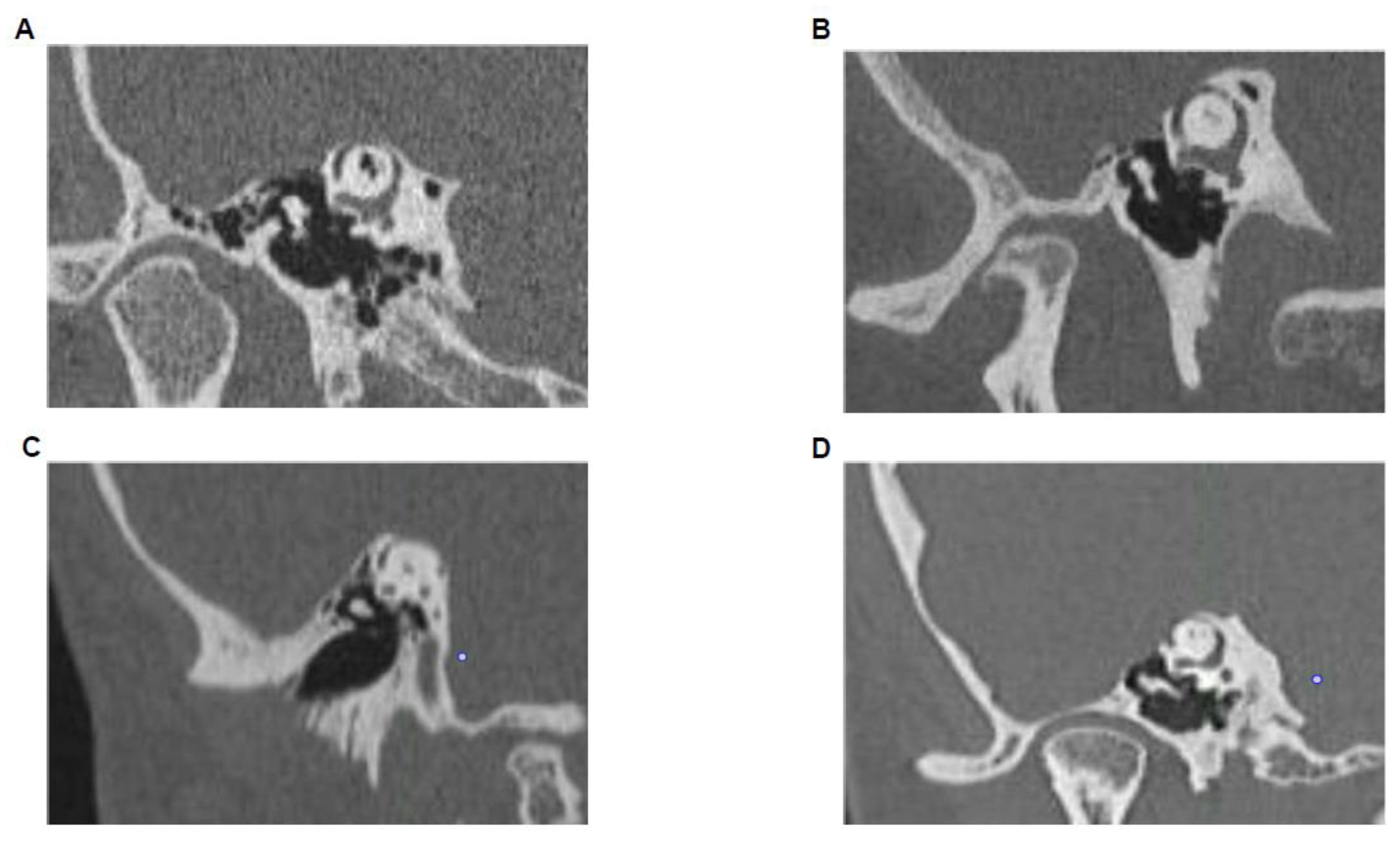 Audiolres 11 00042 g002 550