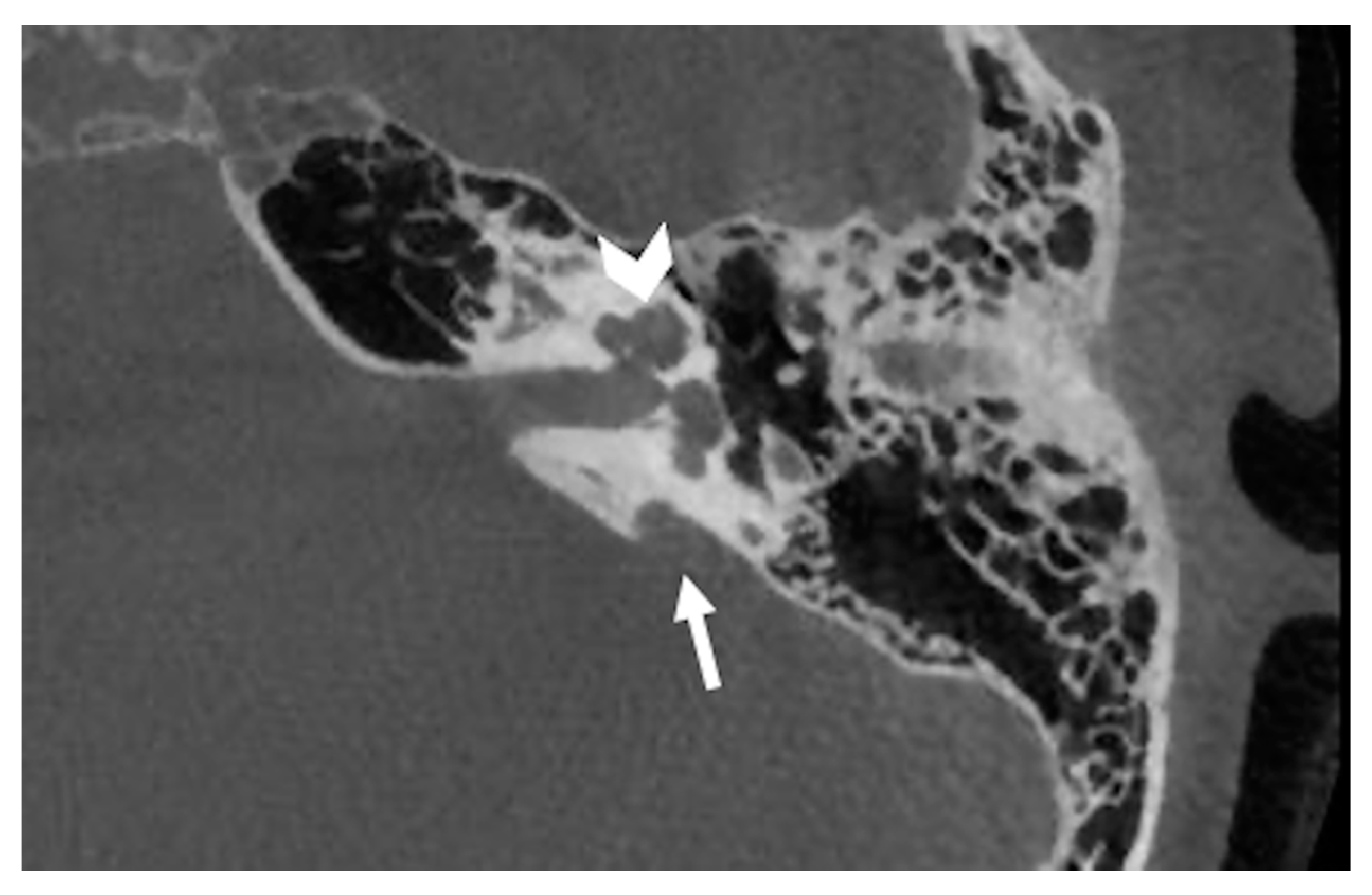 Audiolres 11 00047 g005