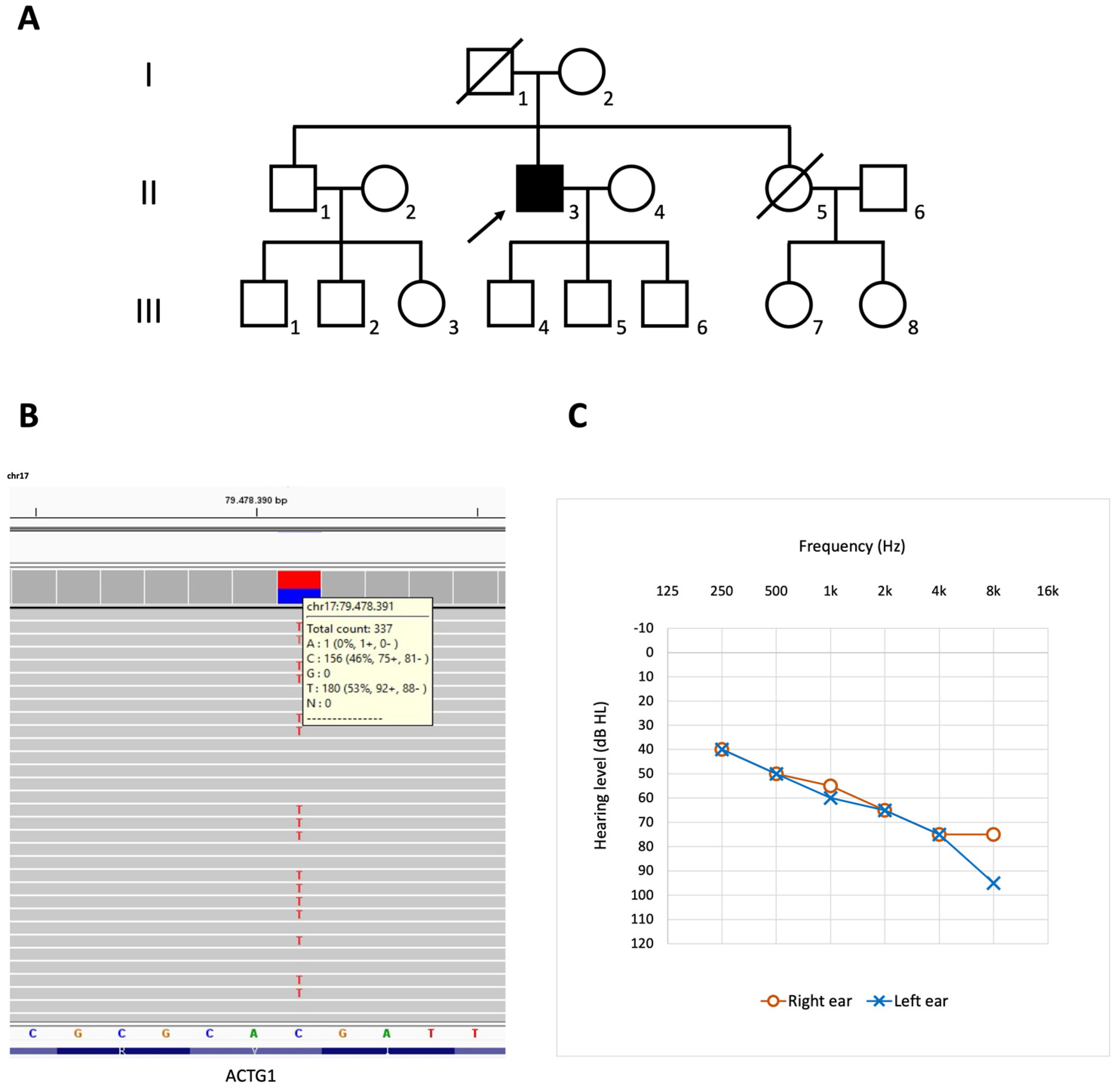 Audiolres 11 00052 g001 Audiolres 11 00052 g001