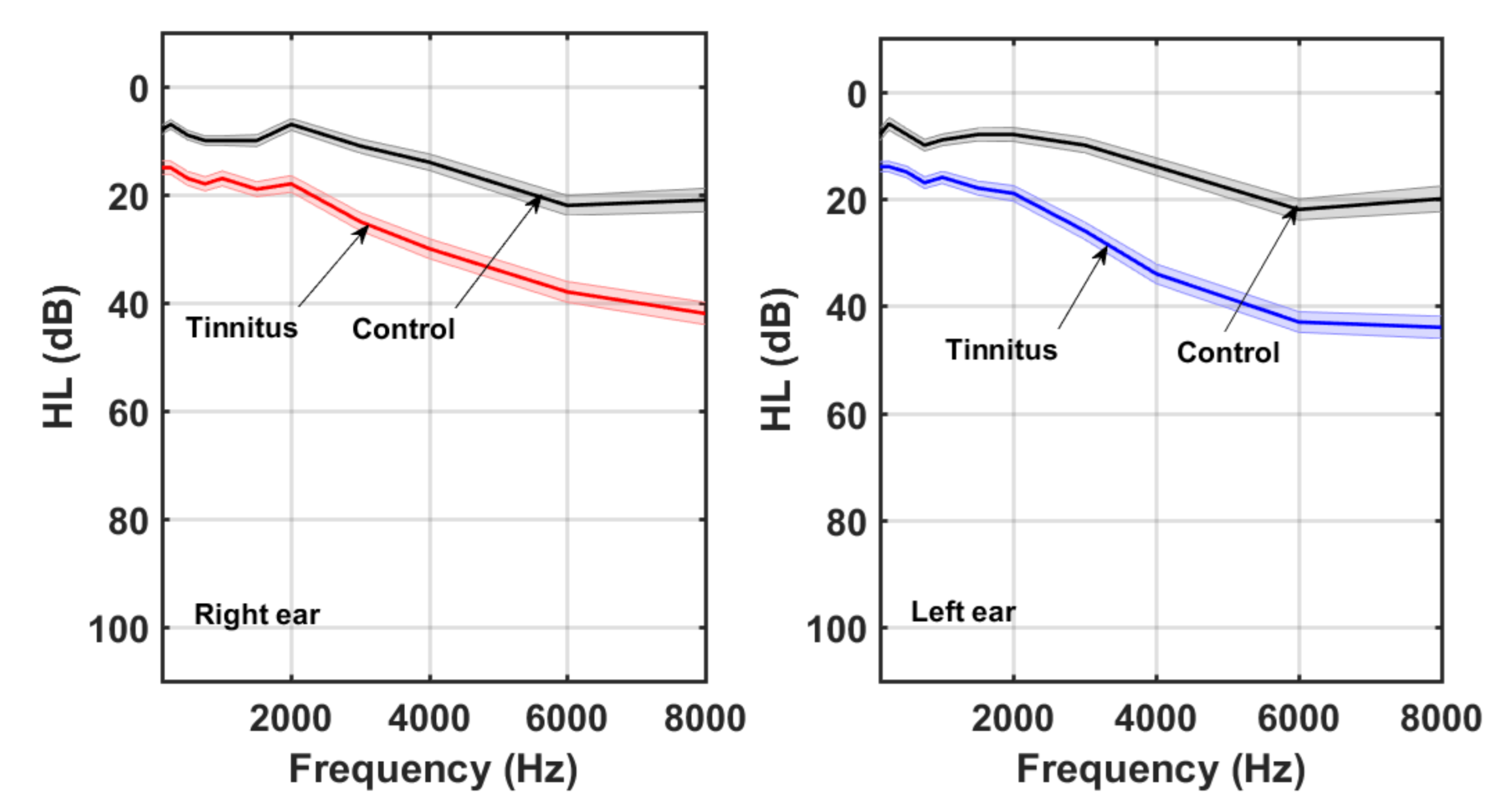 Audiolres 11 00053 g001 550