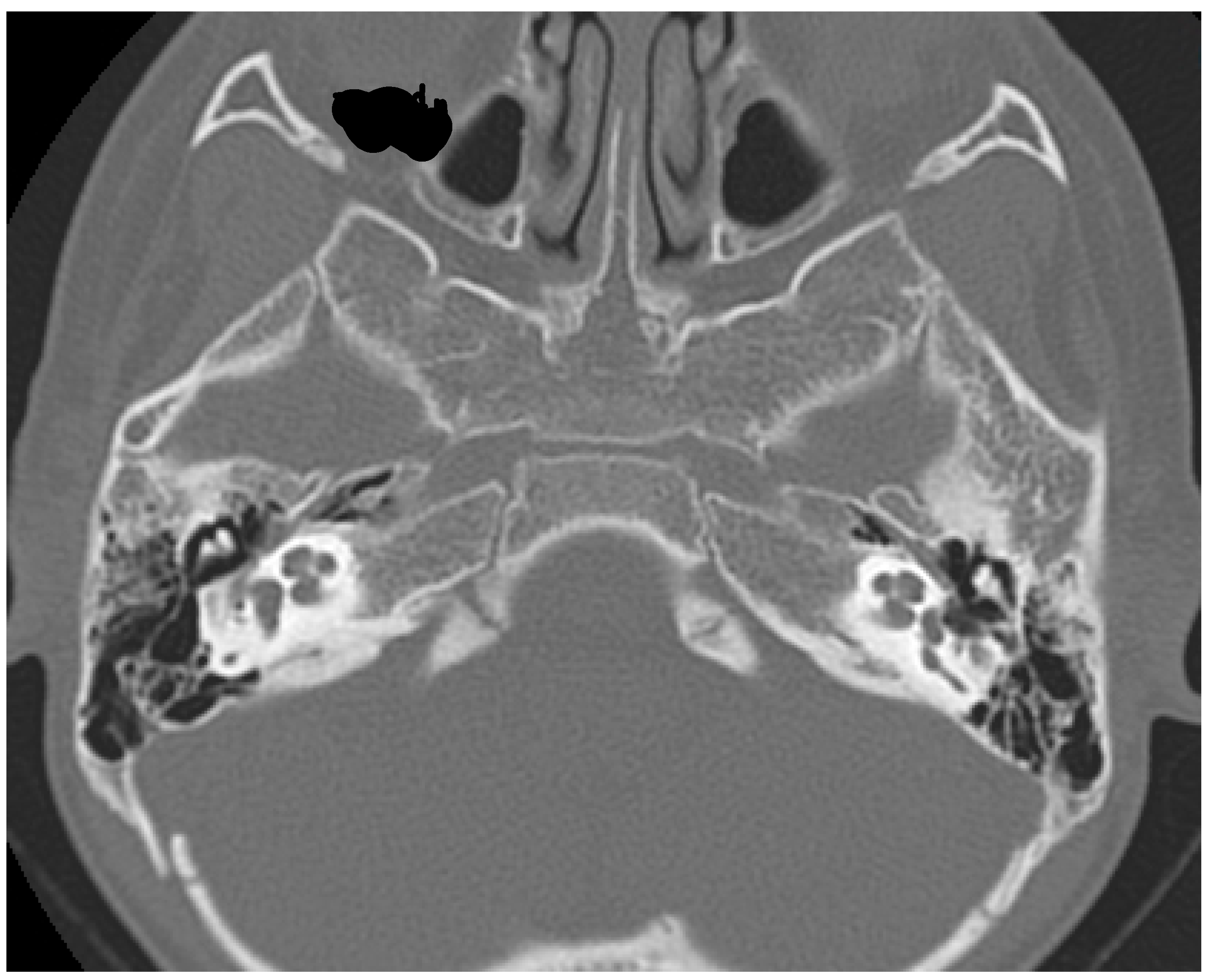 Audiolres 11 00055 g001