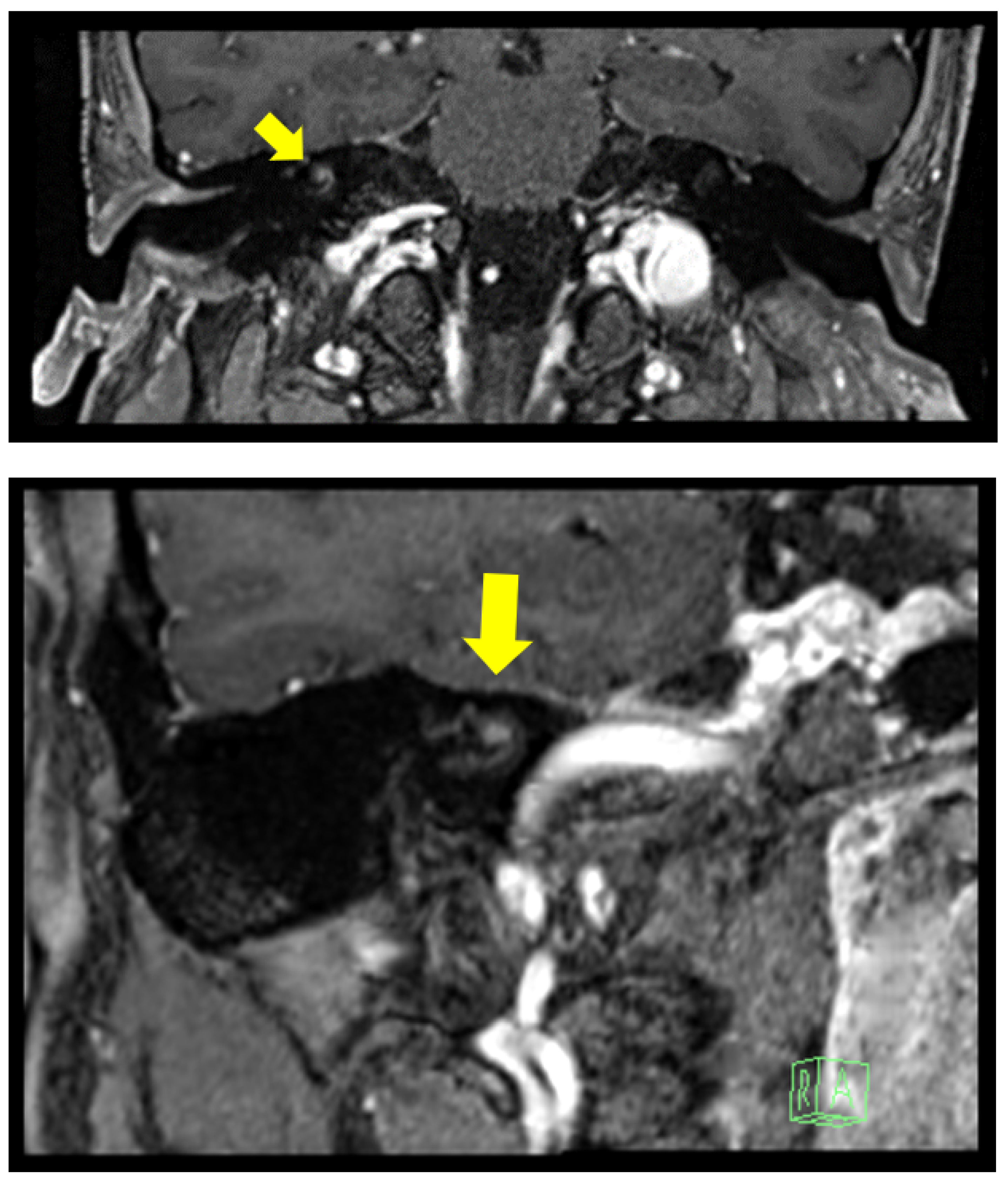 Audiolres 12 00004 g002 550