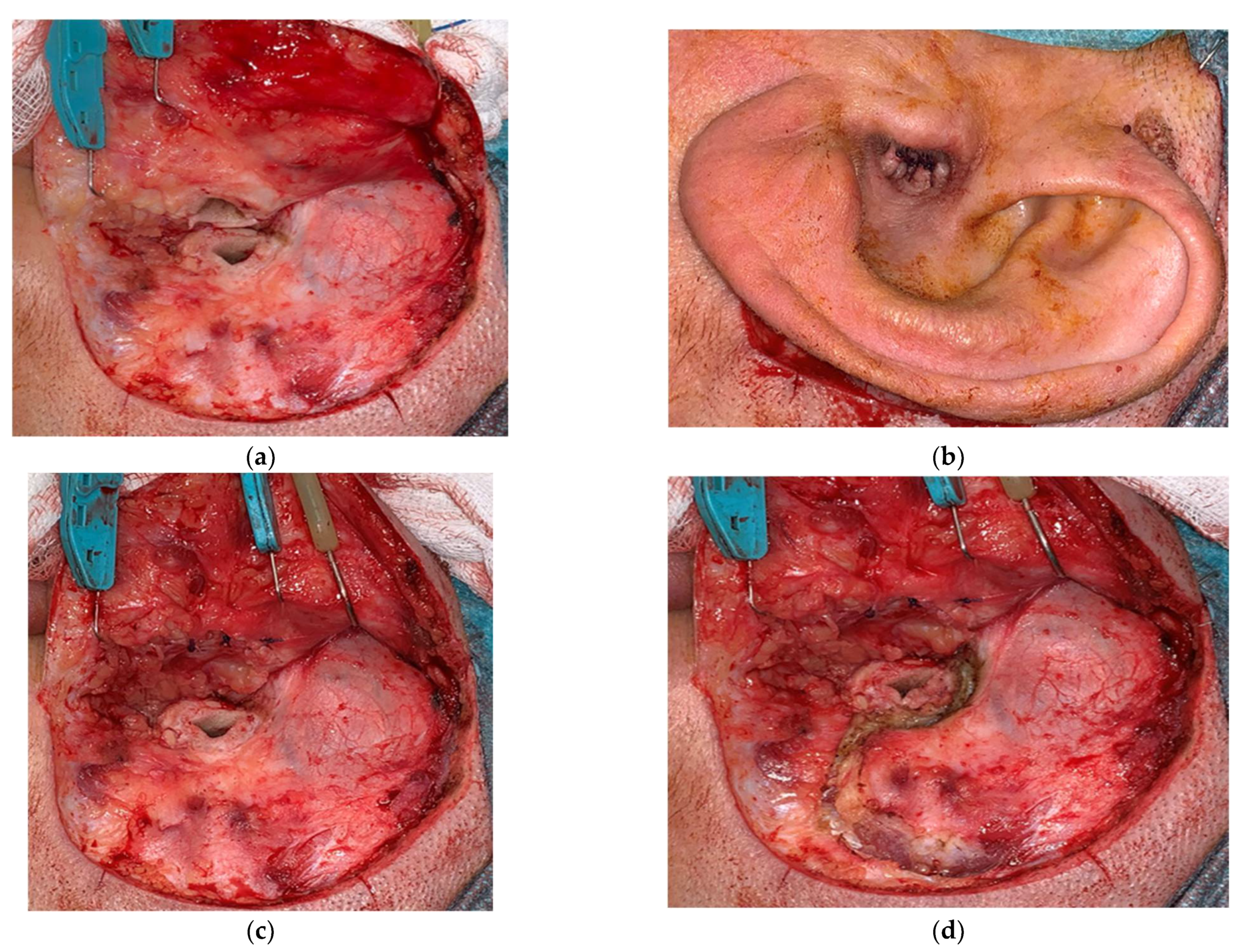 Audiolres 12 00014 g001a 550