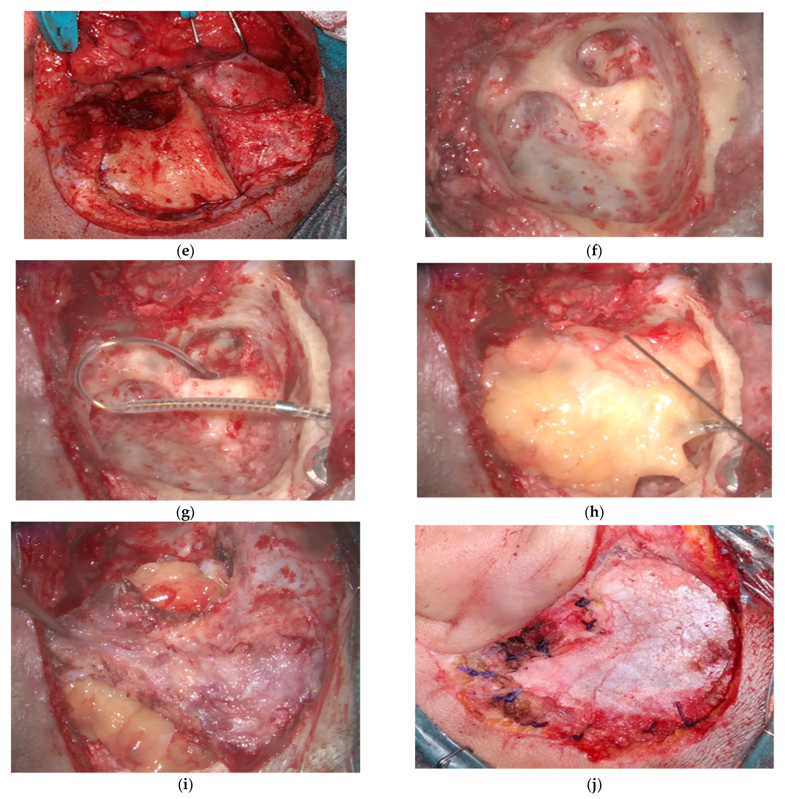 Audiolres 12 00014 g001b 550