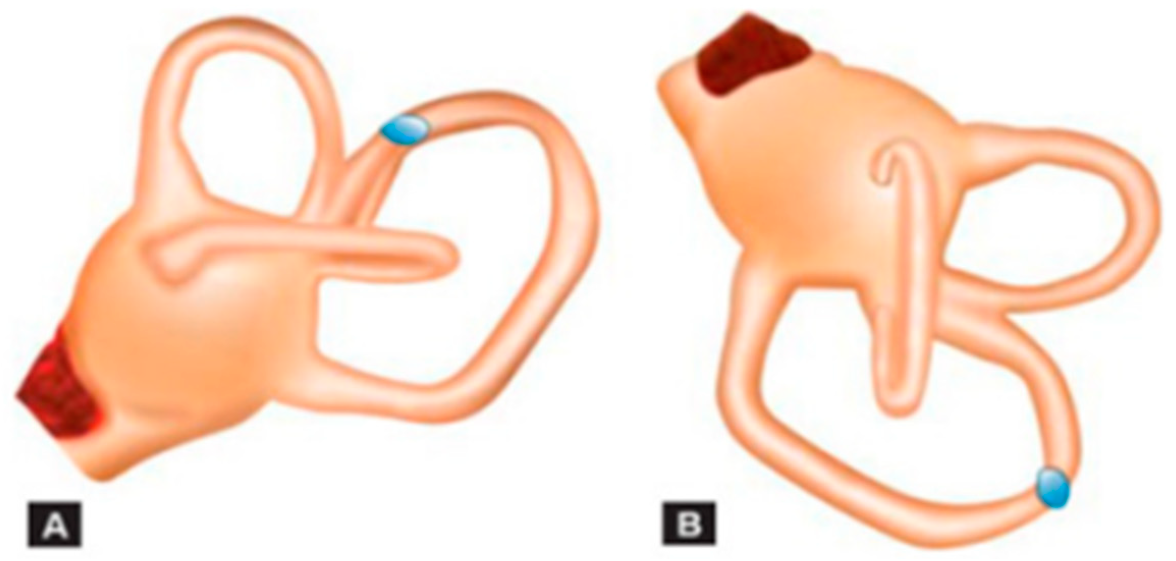 Audiolres 12 00018 g002