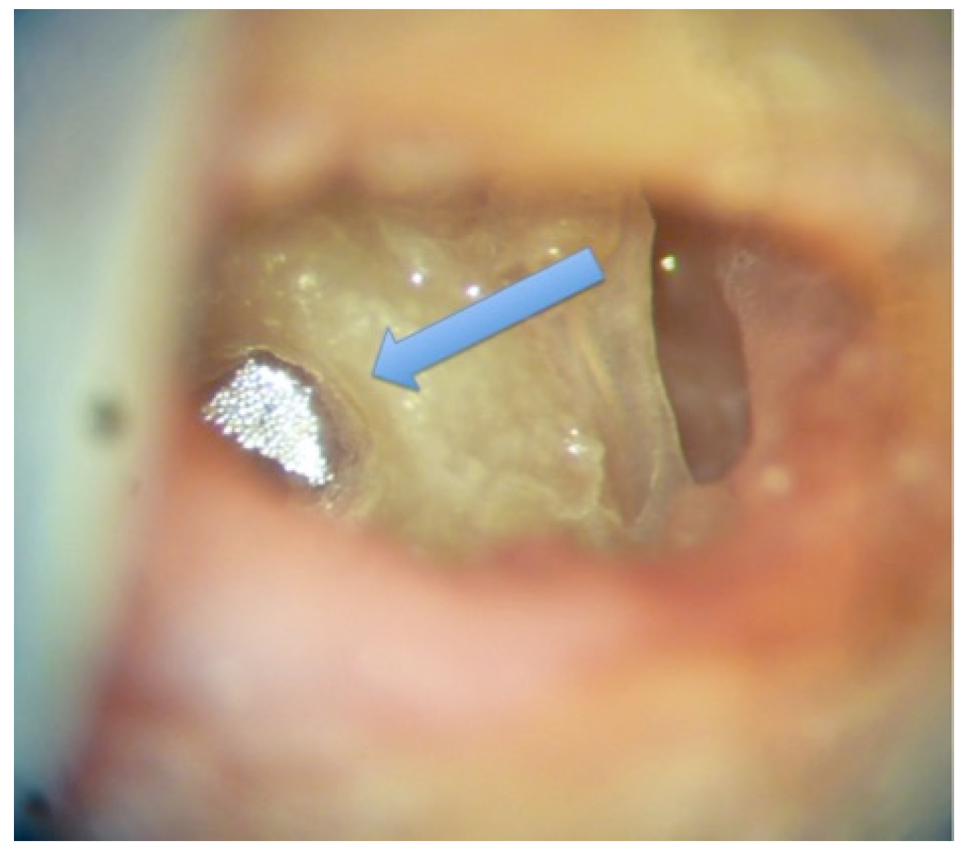 Audiolres 12 00019 g001 550