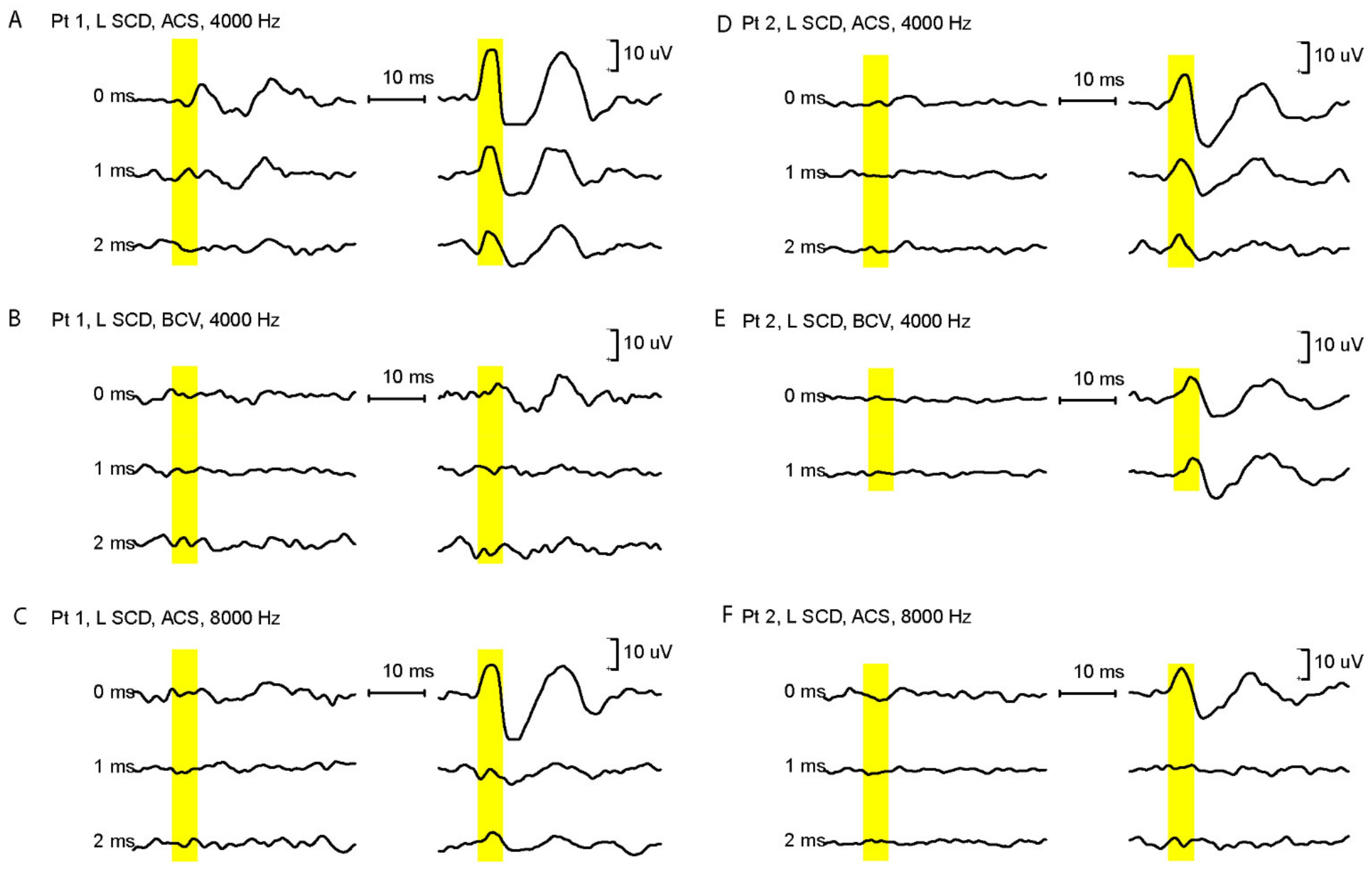 Audiolres 12 00046 g001