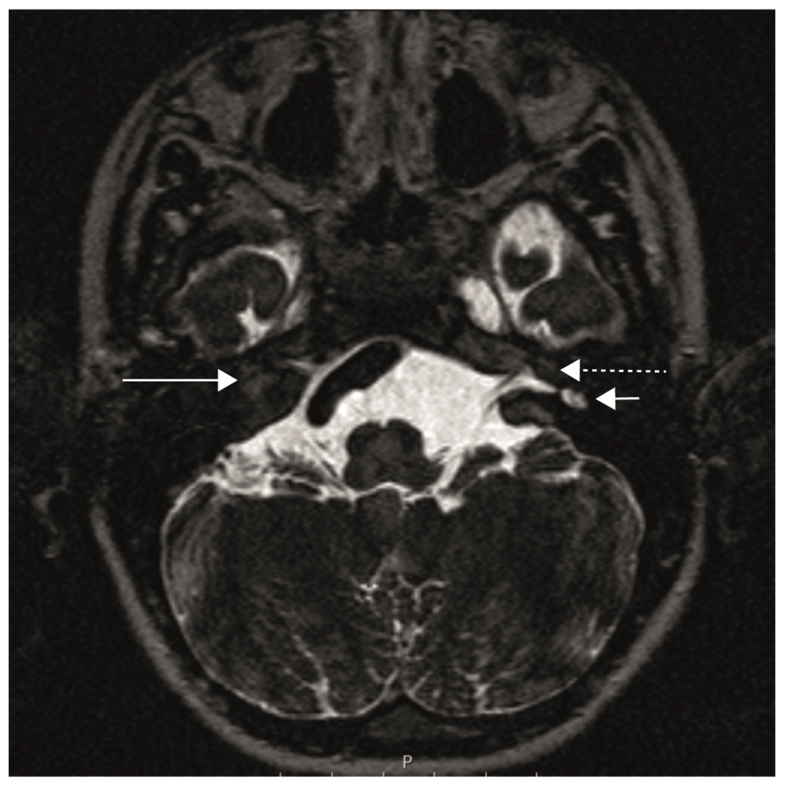 Audiolres 13 00040 g001