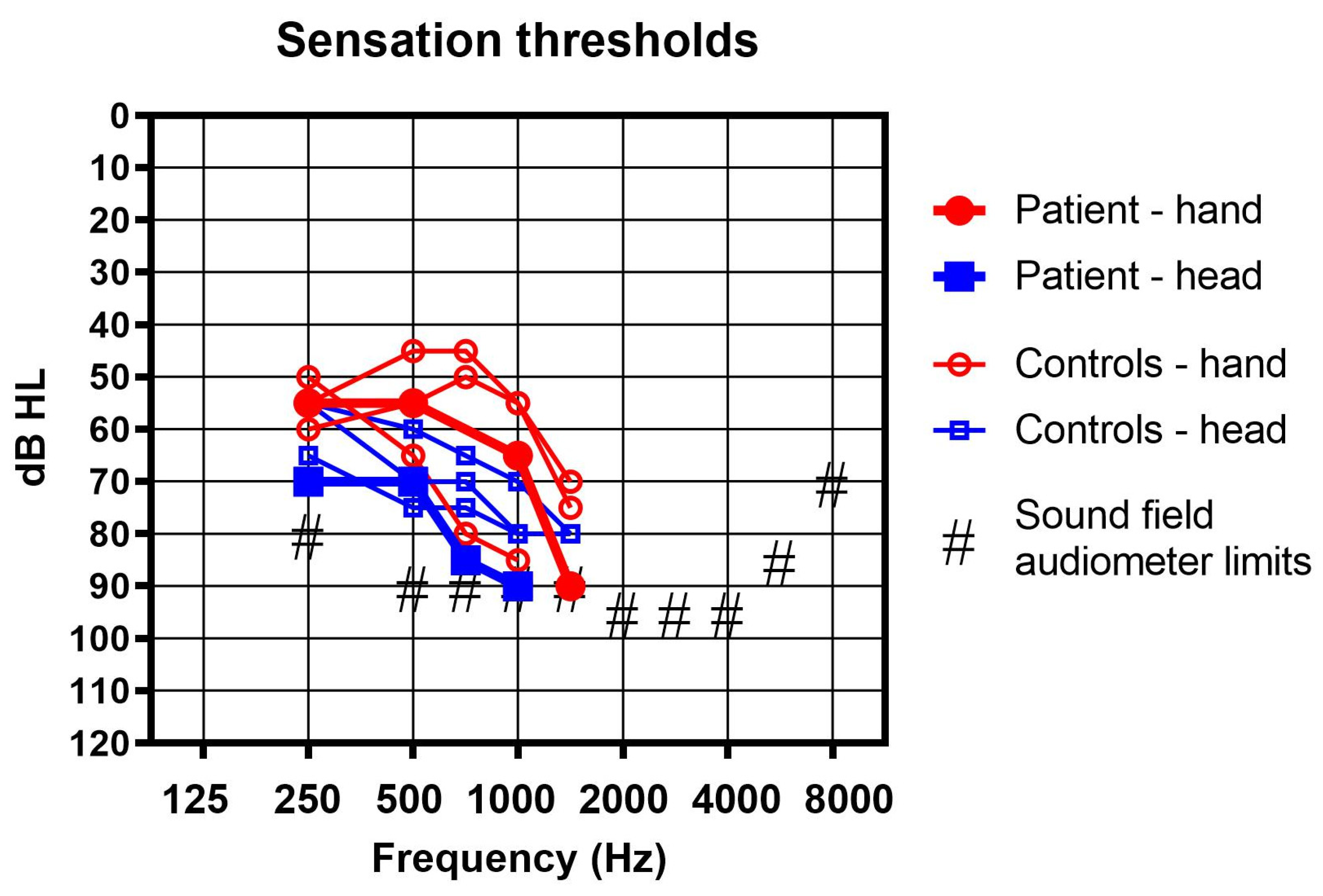 Audiology Research Free FullText Using a Bone Conduction Hearing