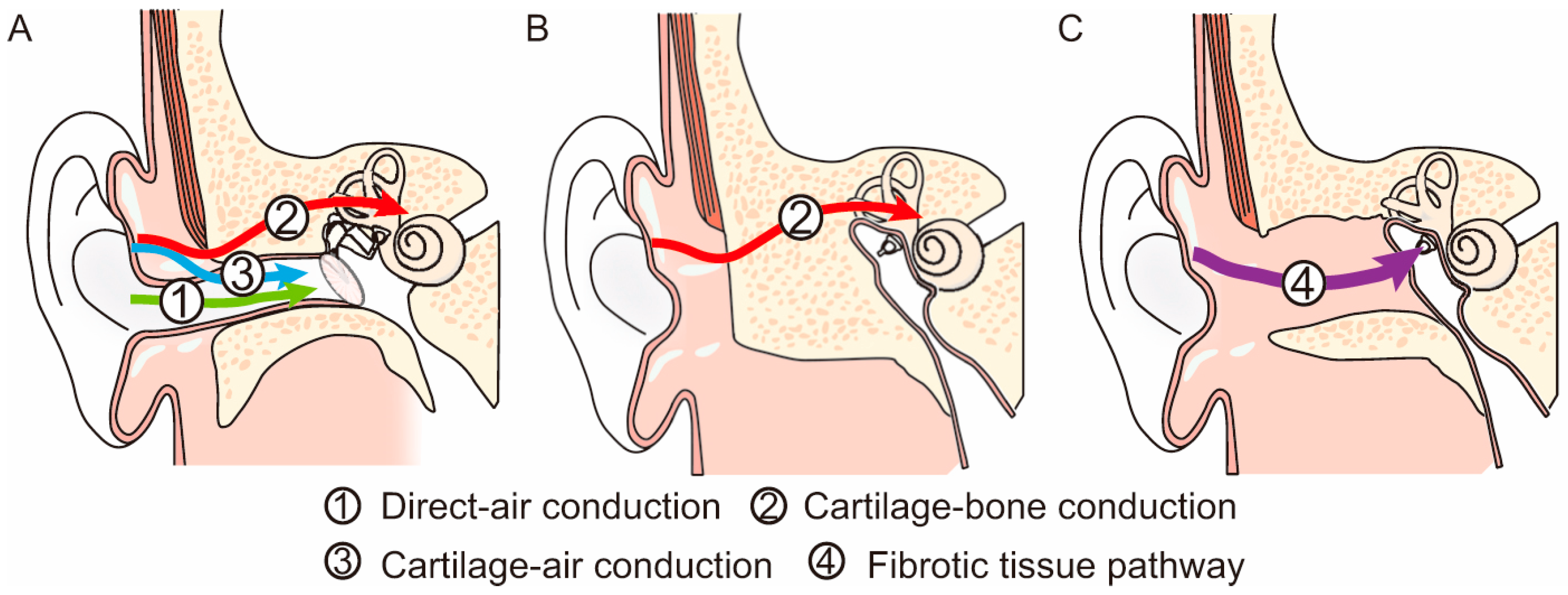 Audiolres 13 00045 g001