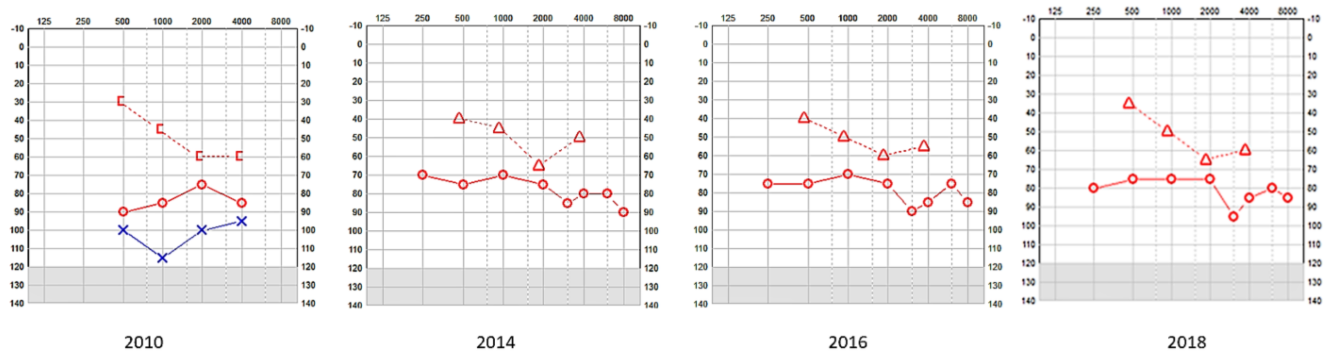 Audiolres 13 00052 g001