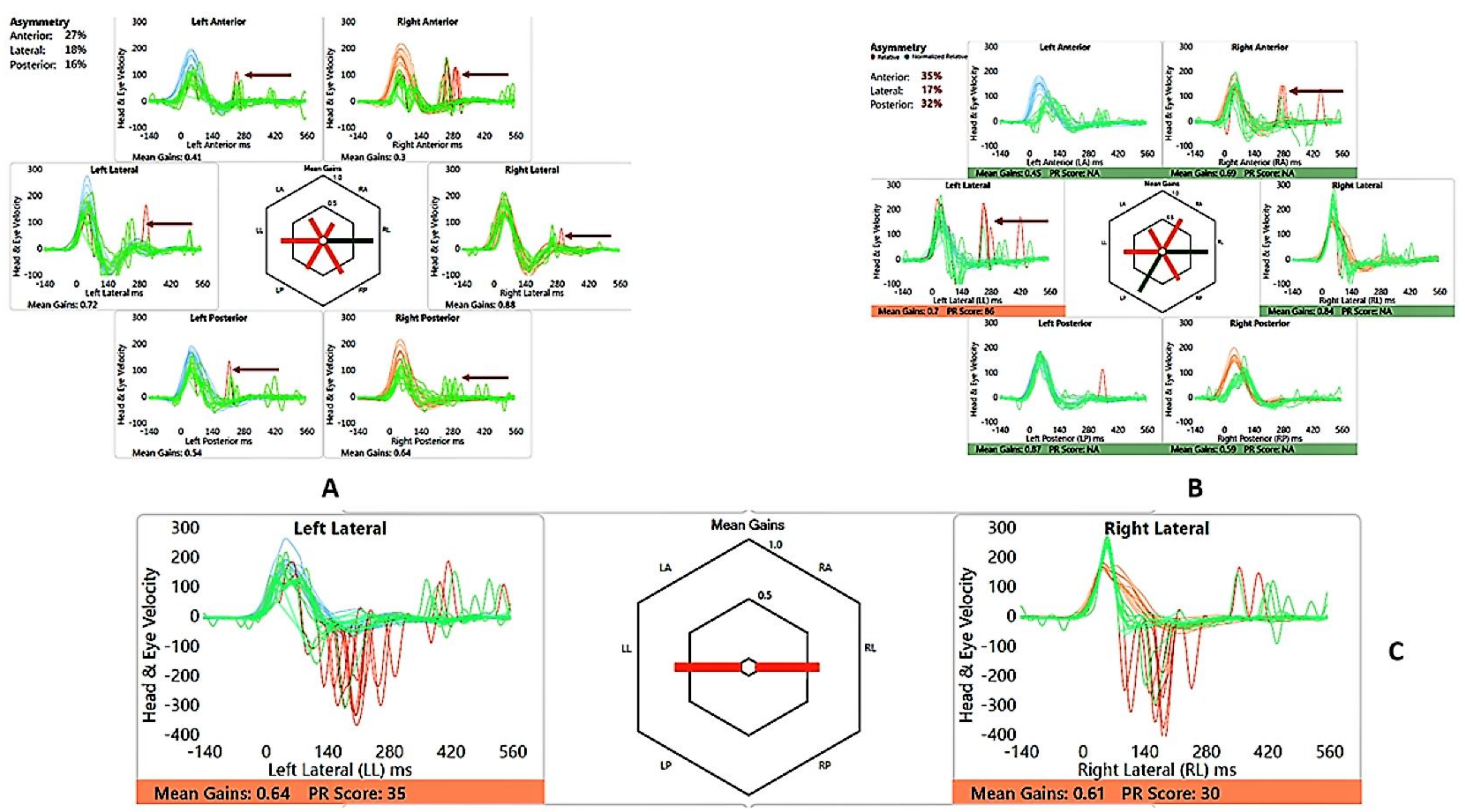 Audiolres 13 00052 g004