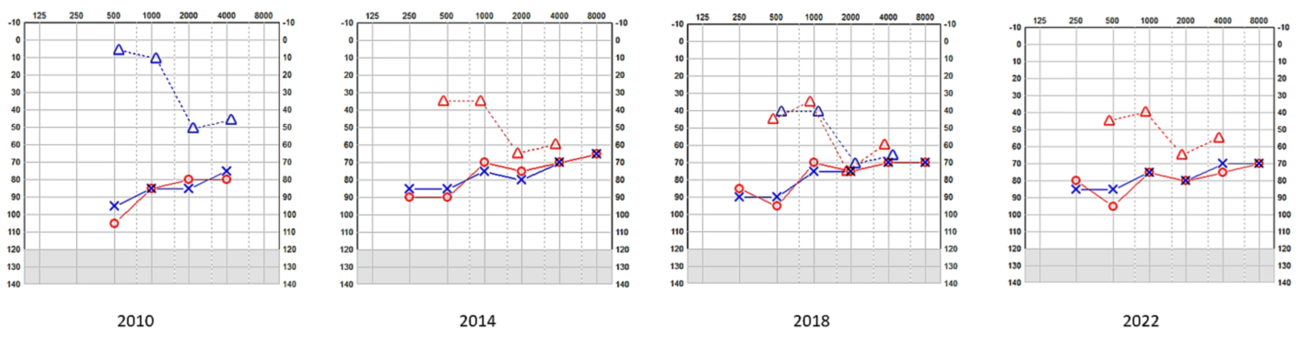 Audiolres 13 00052 g005