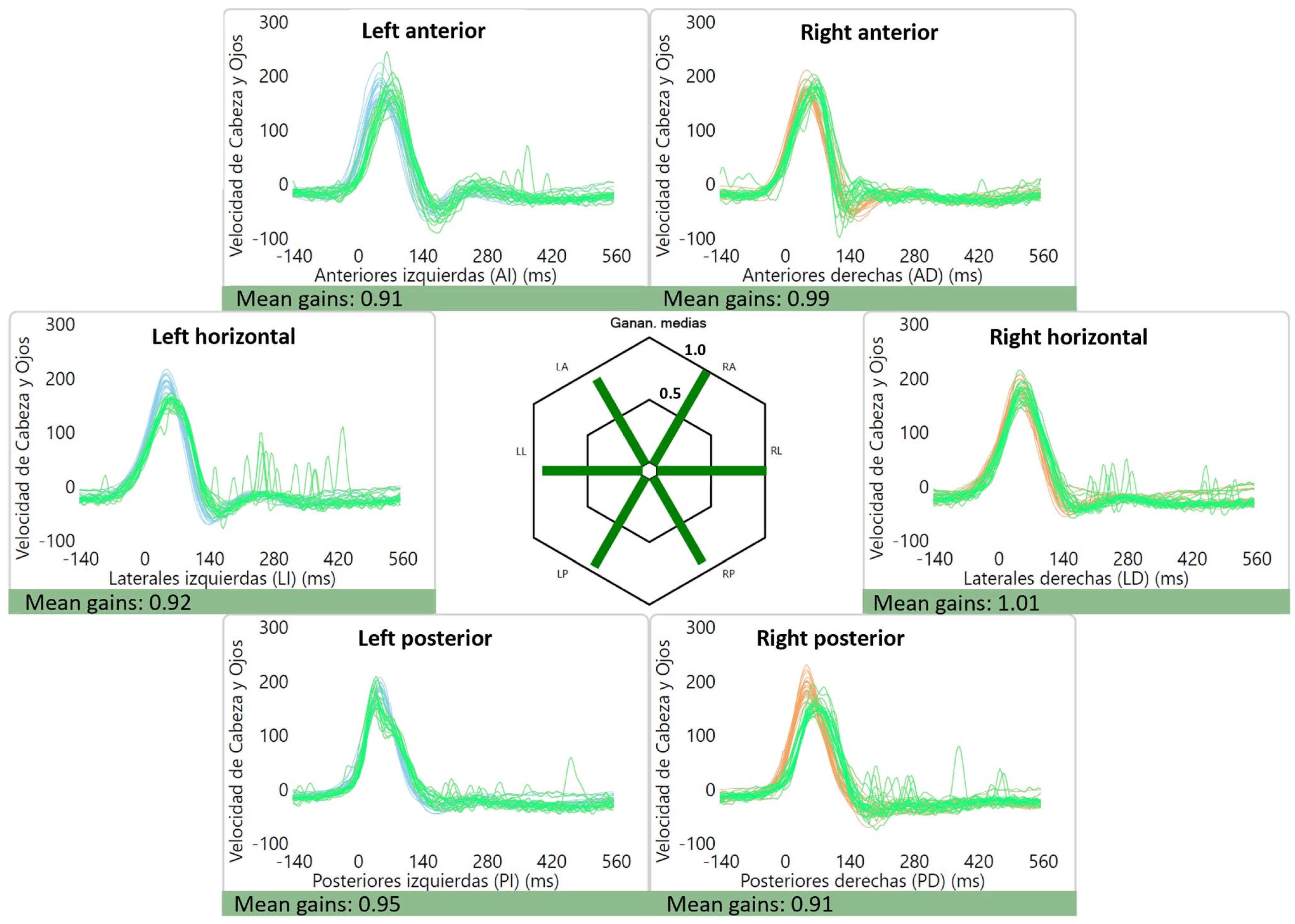Audiolres 13 00053 g003 Audiolres 13 00053 g003