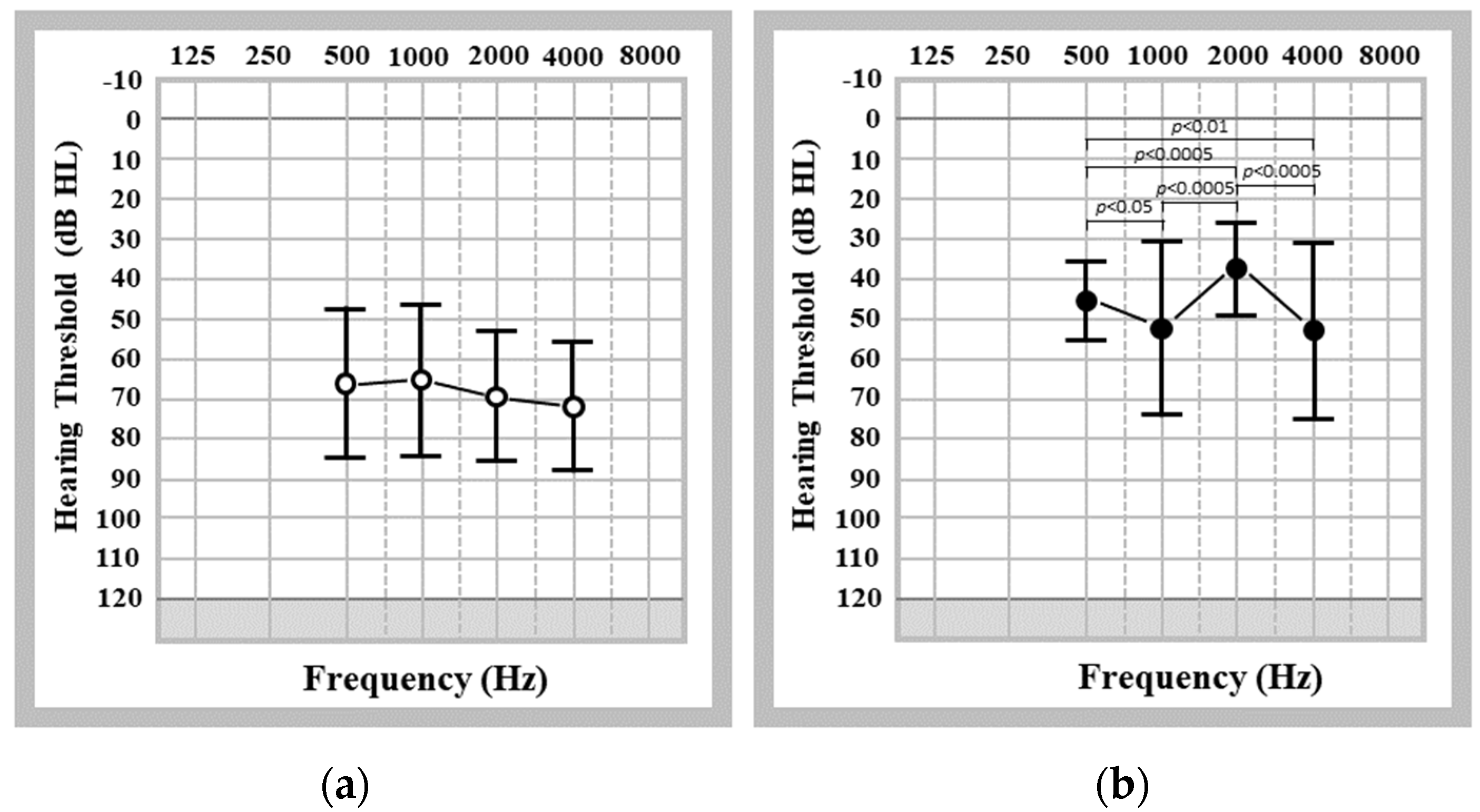 Audiolres 13 00055 g003