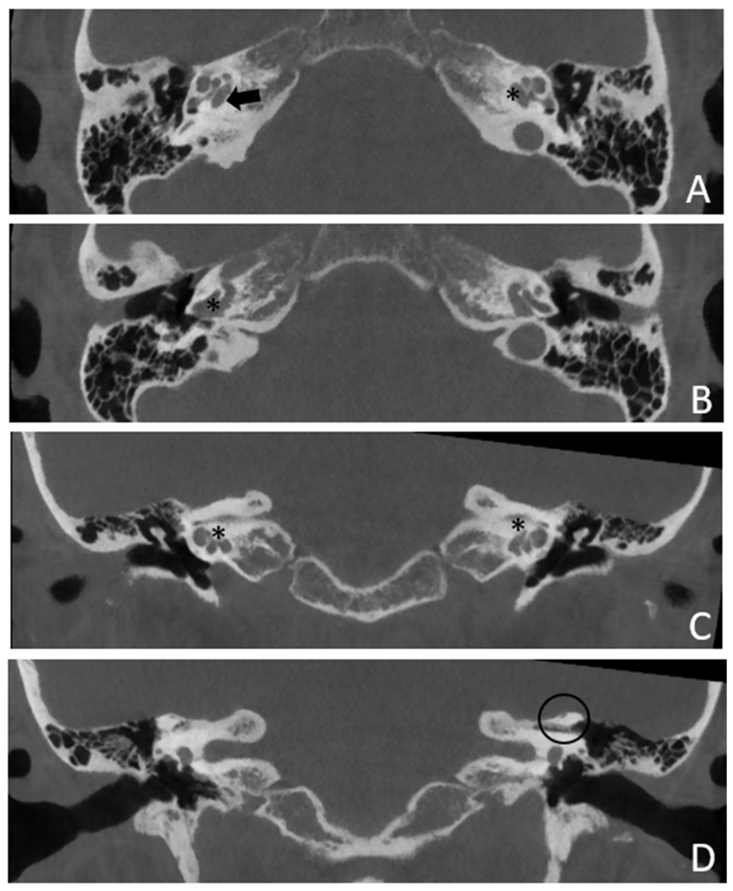 Audiolres 13 00072 g005