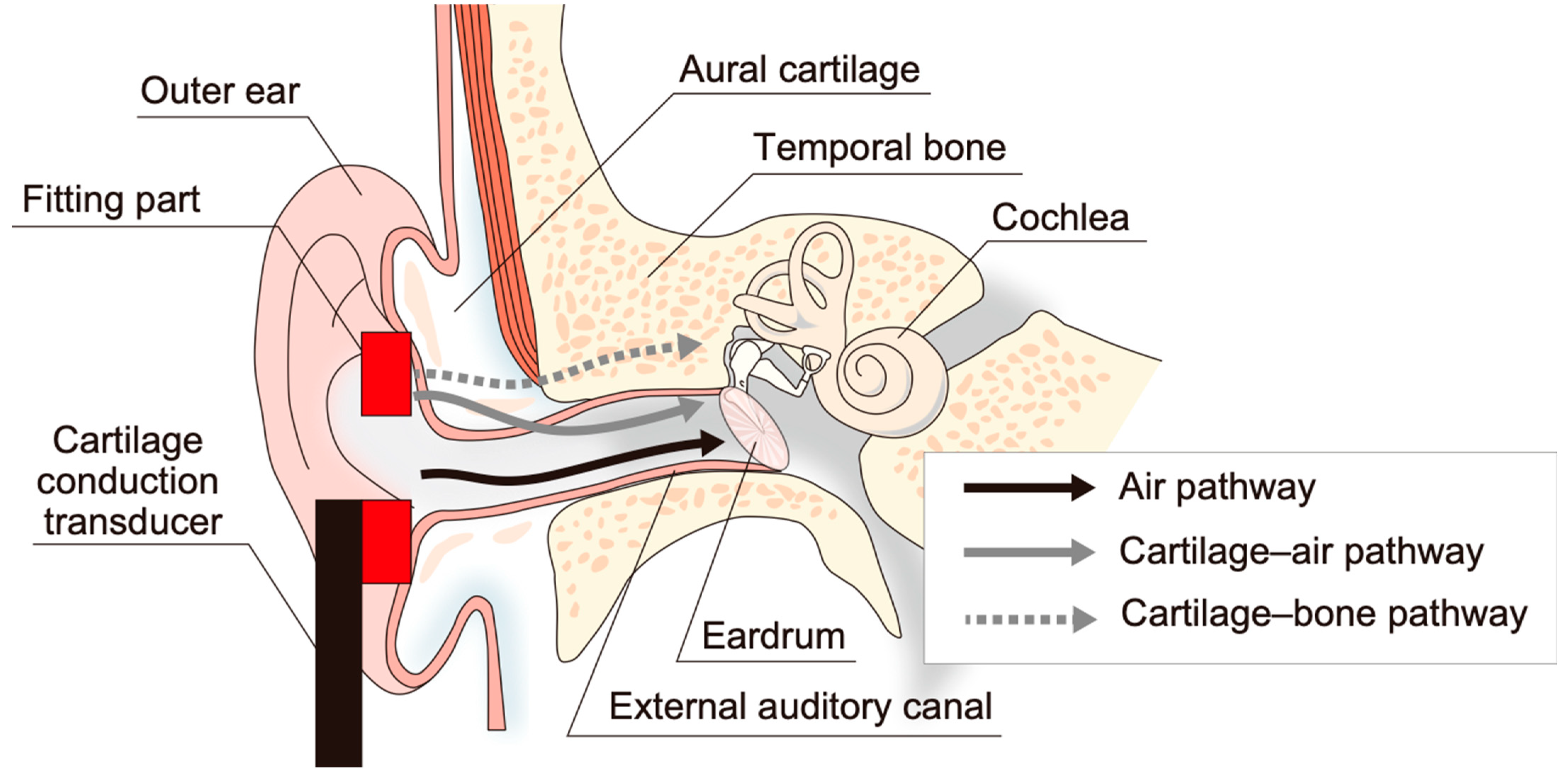 Audiolres 13 00078 g001