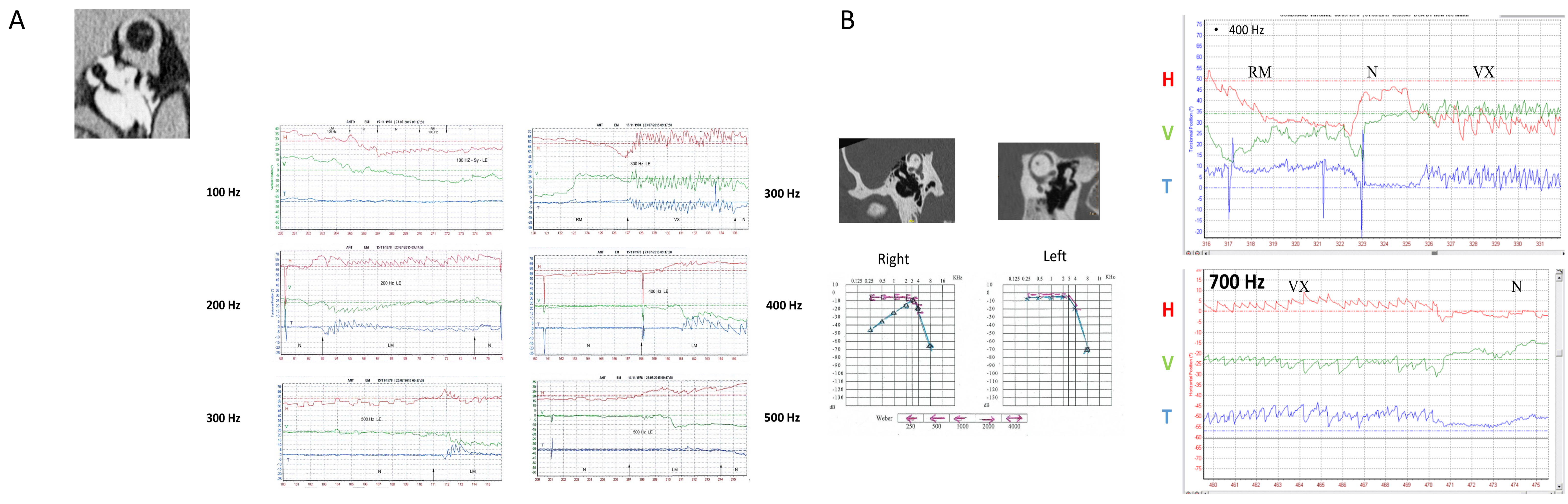 Audiolres 14 00009 g003