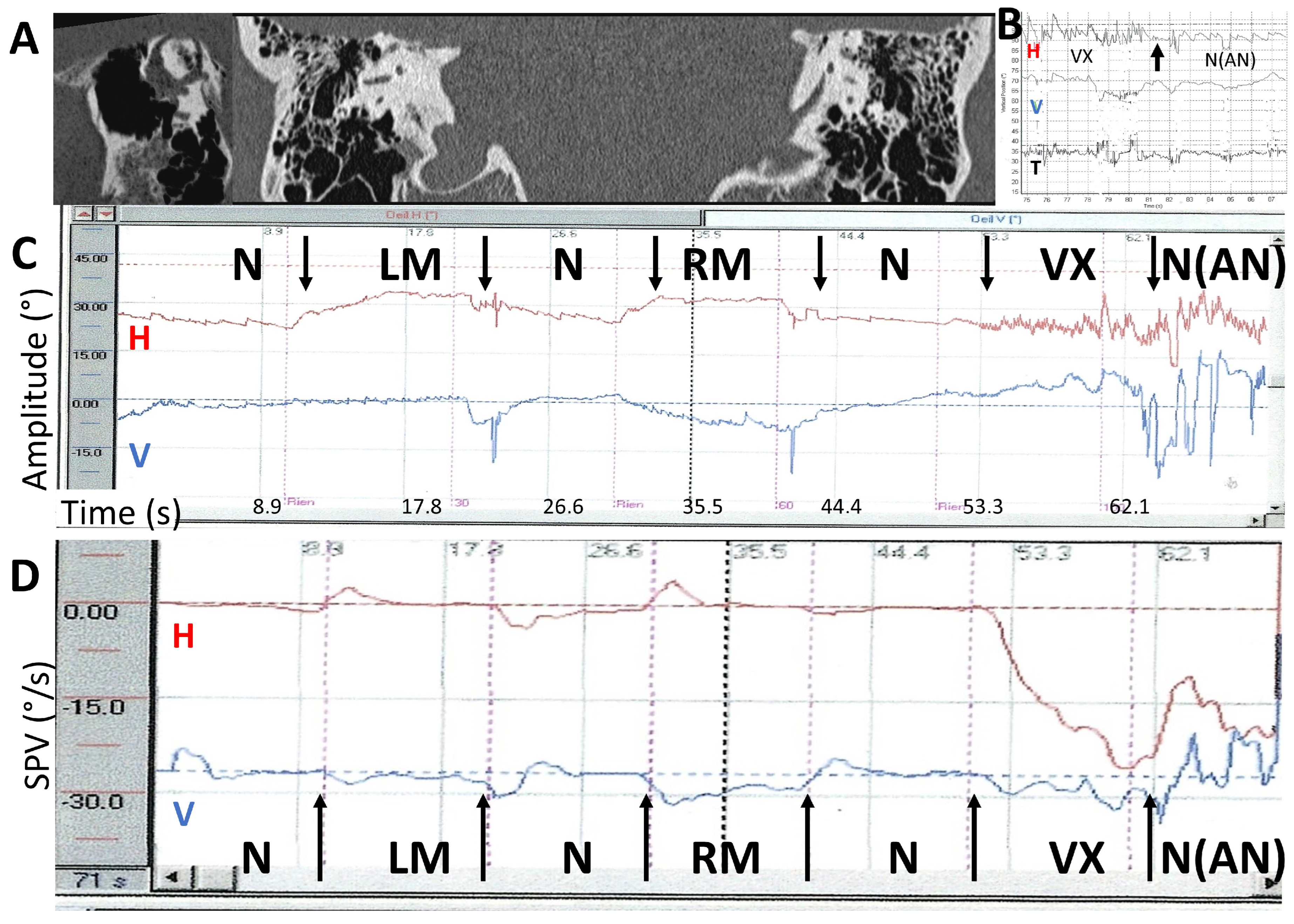 Audiolres 14 00009 g007