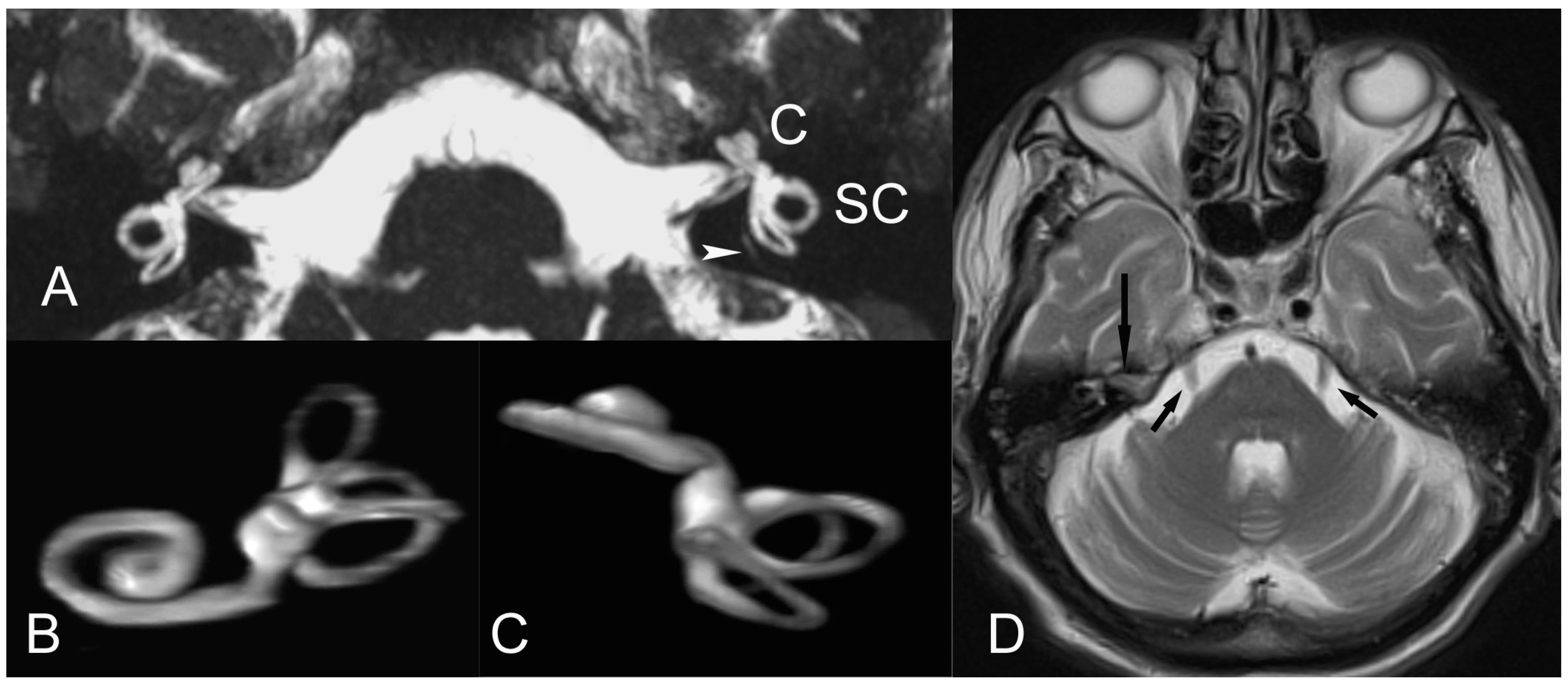 Audiolres 14 00015 g001