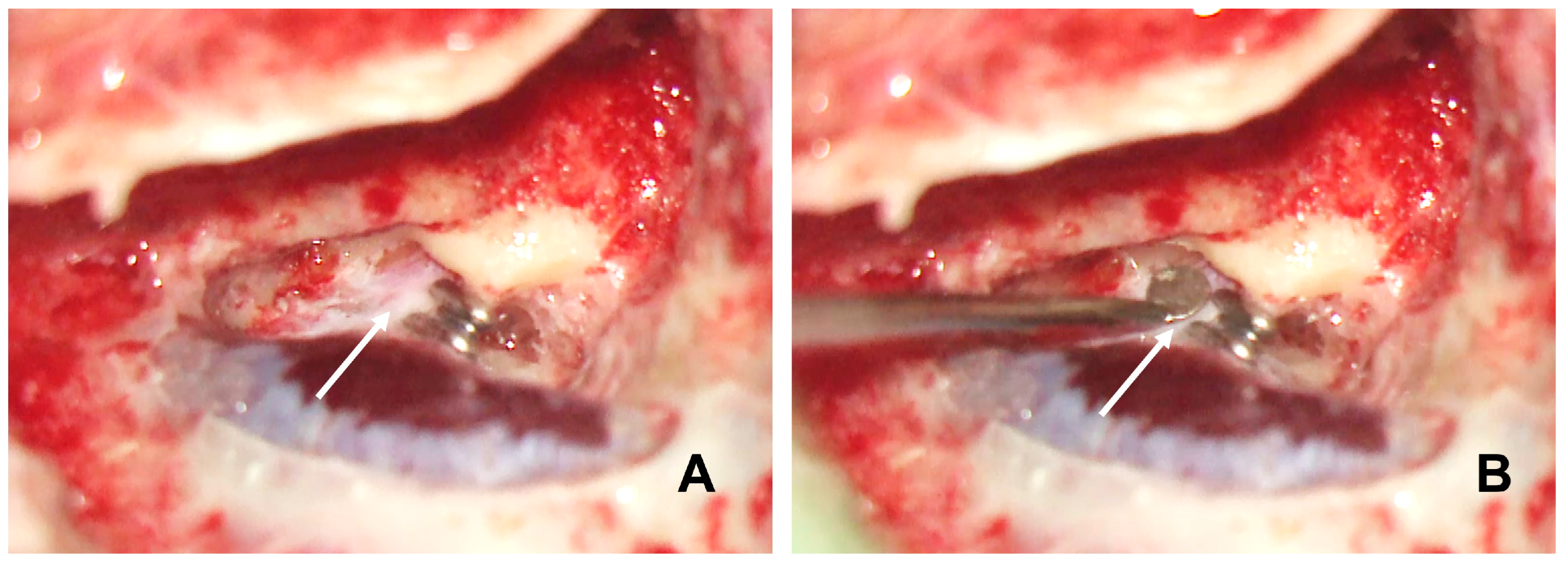 Audiolres 14 00027 g002