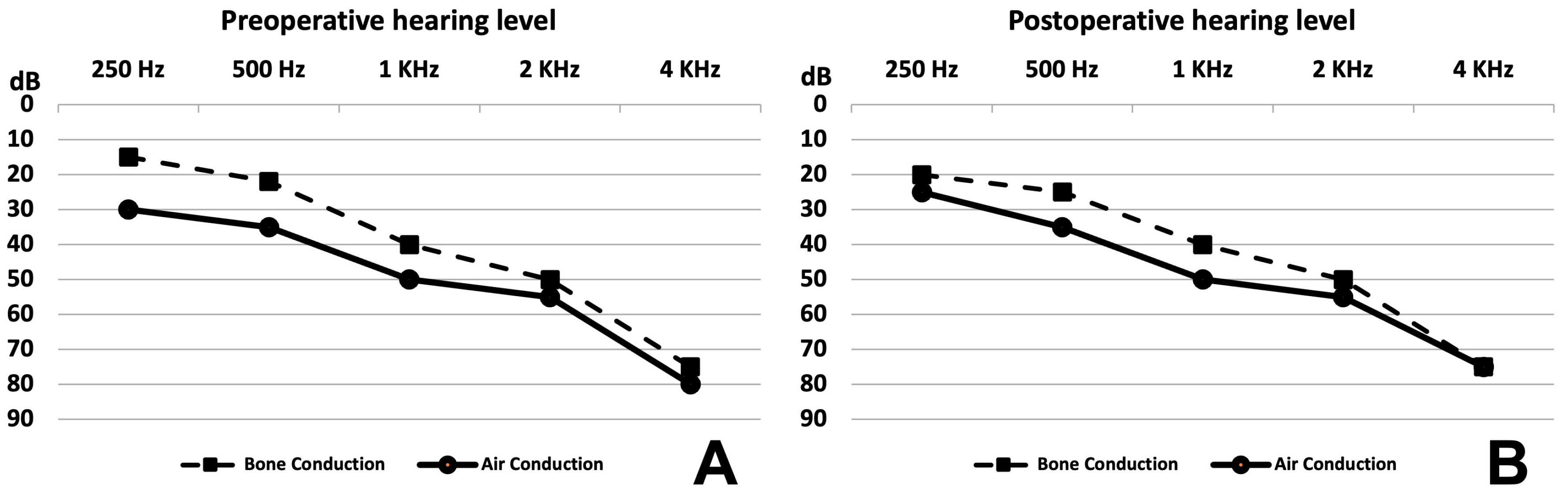 Audiolres 14 00027 g004