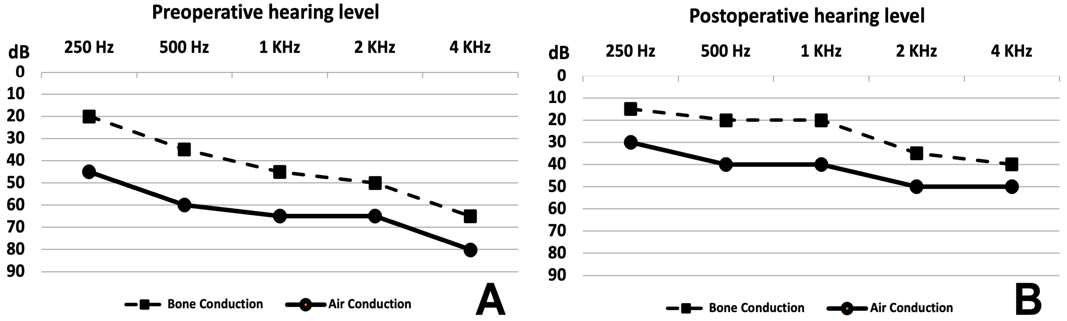 Audiolres 14 00027 g005