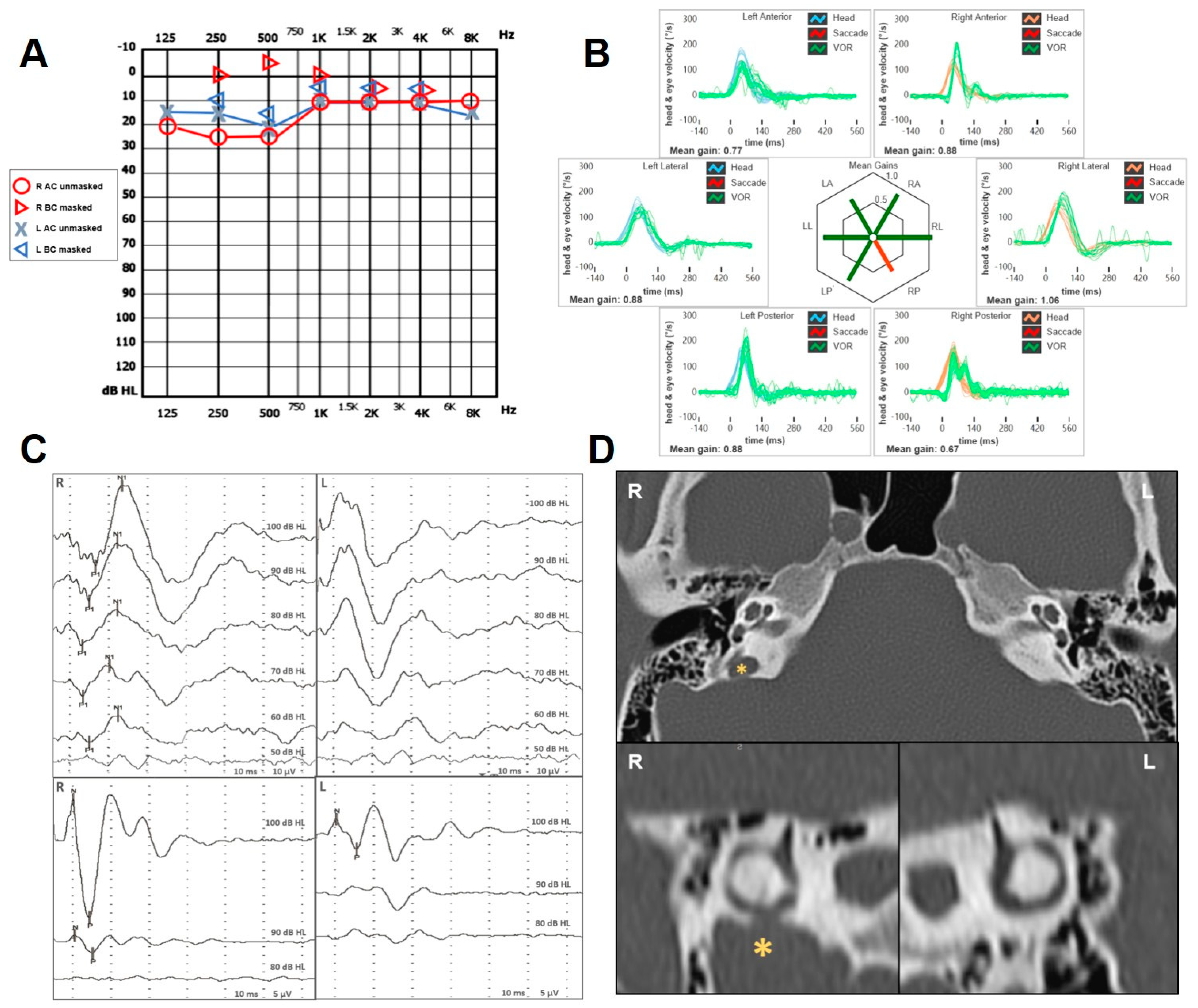 Audiolres 14 00028 g001