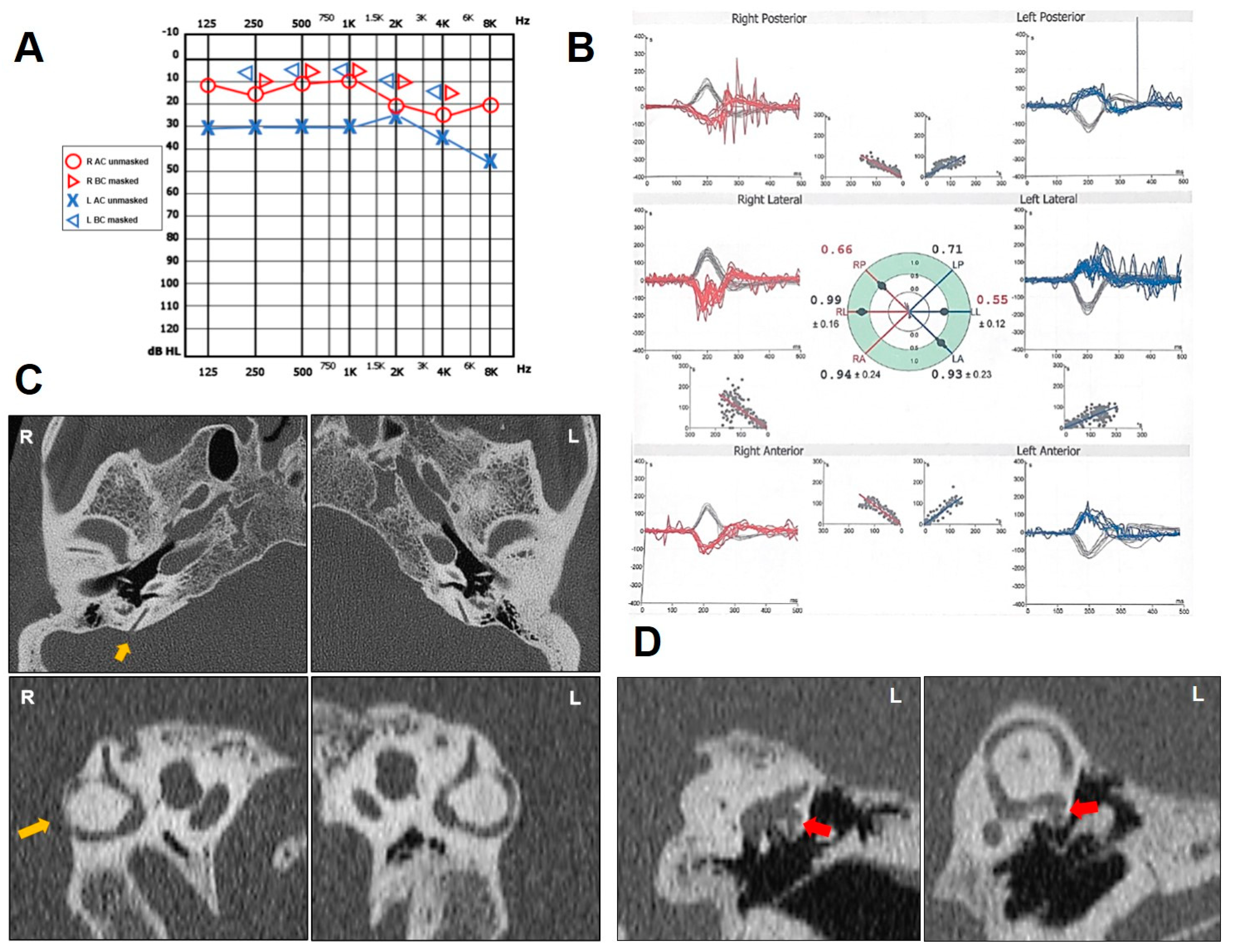 Audiolres 14 00028 g003