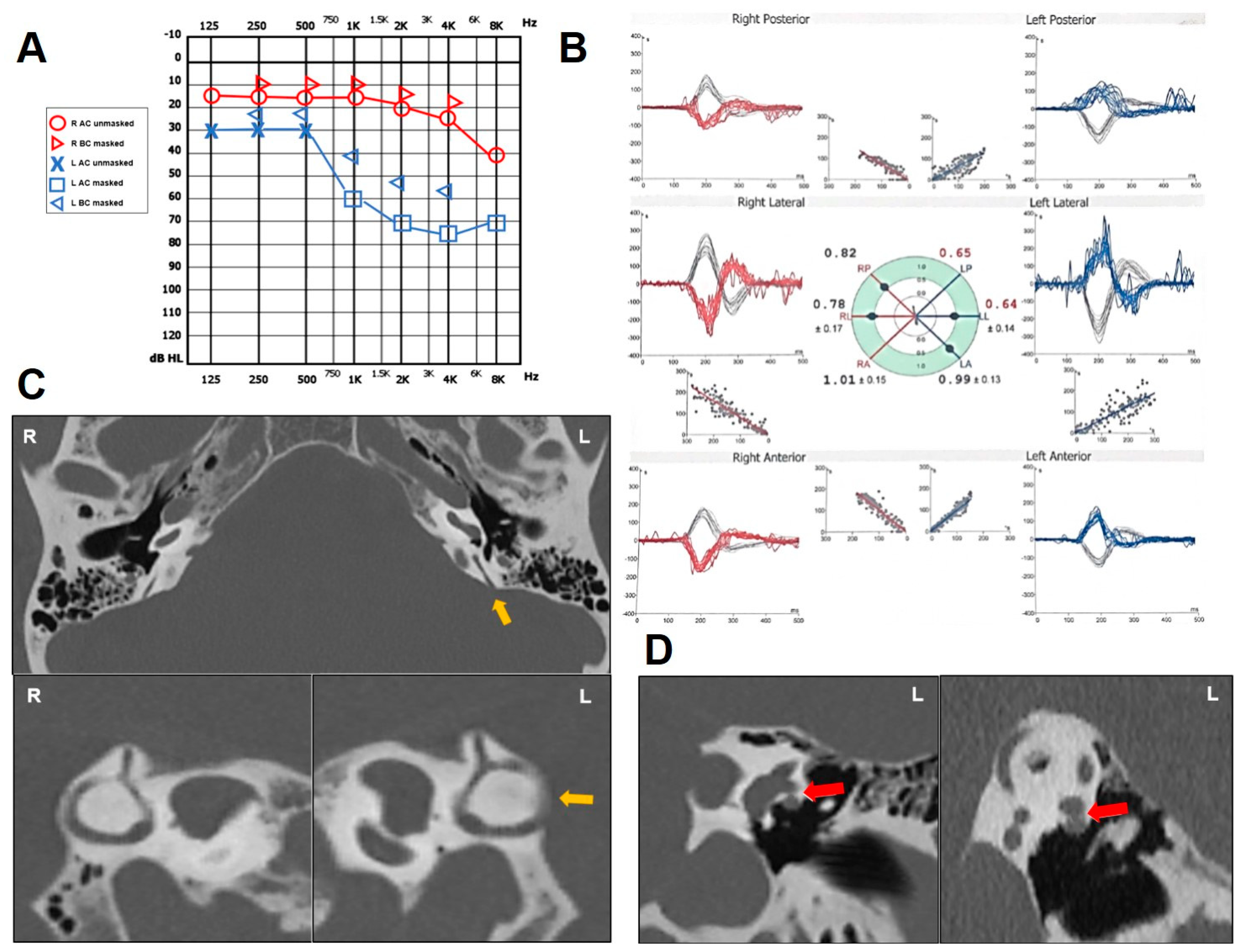 Audiolres 14 00028 g004