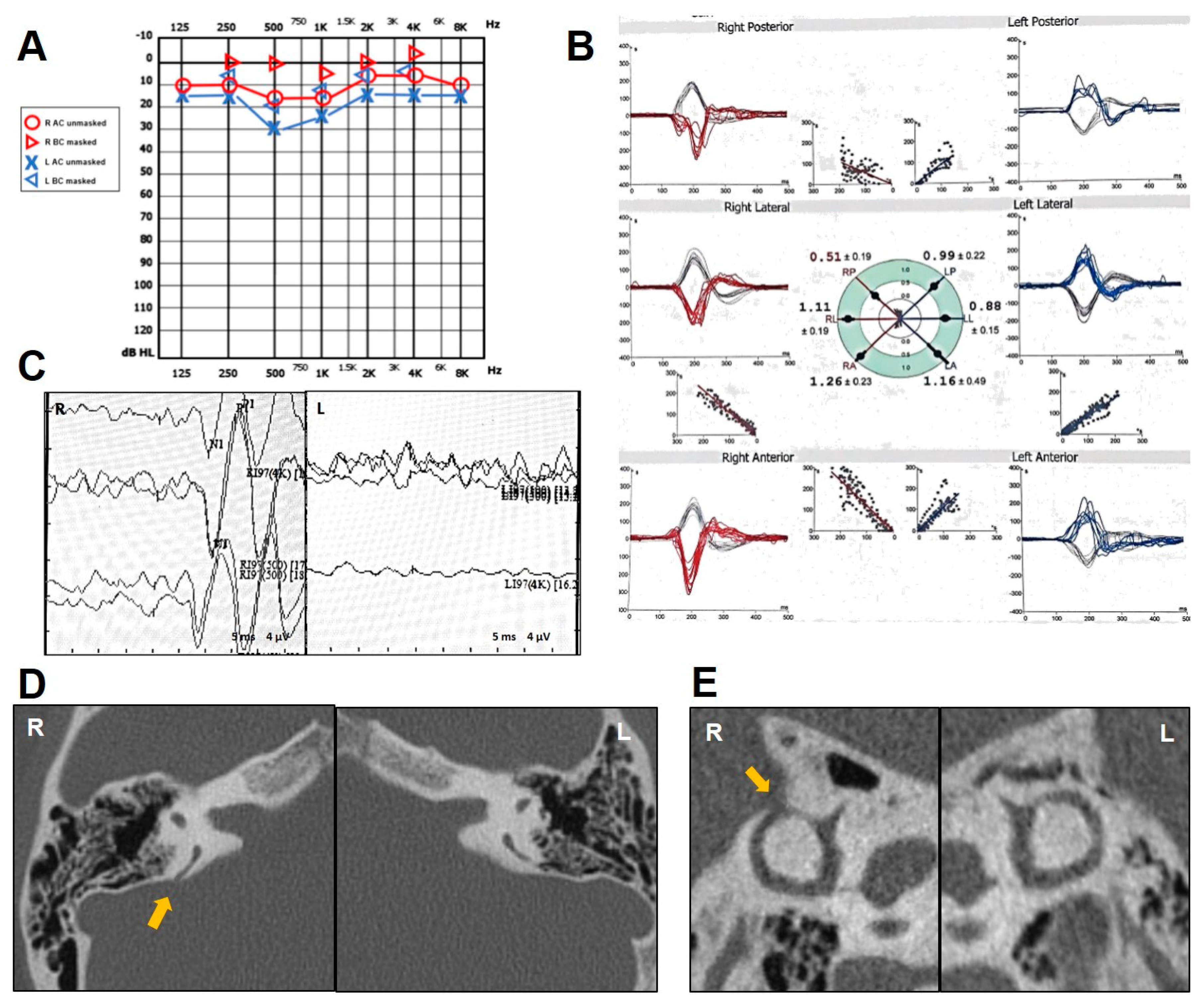 Audiolres 14 00028 g005