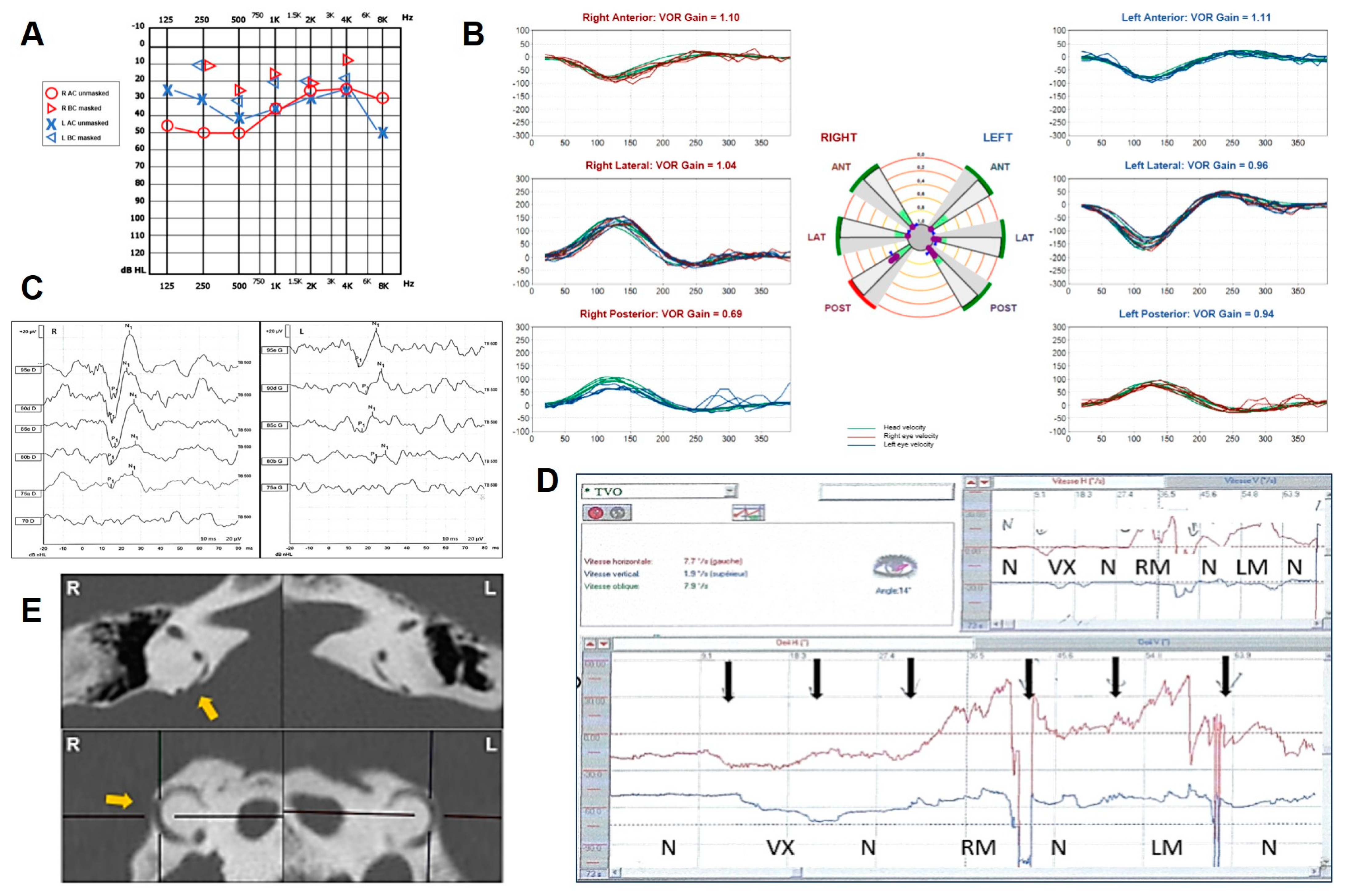 Audiolres 14 00028 g006