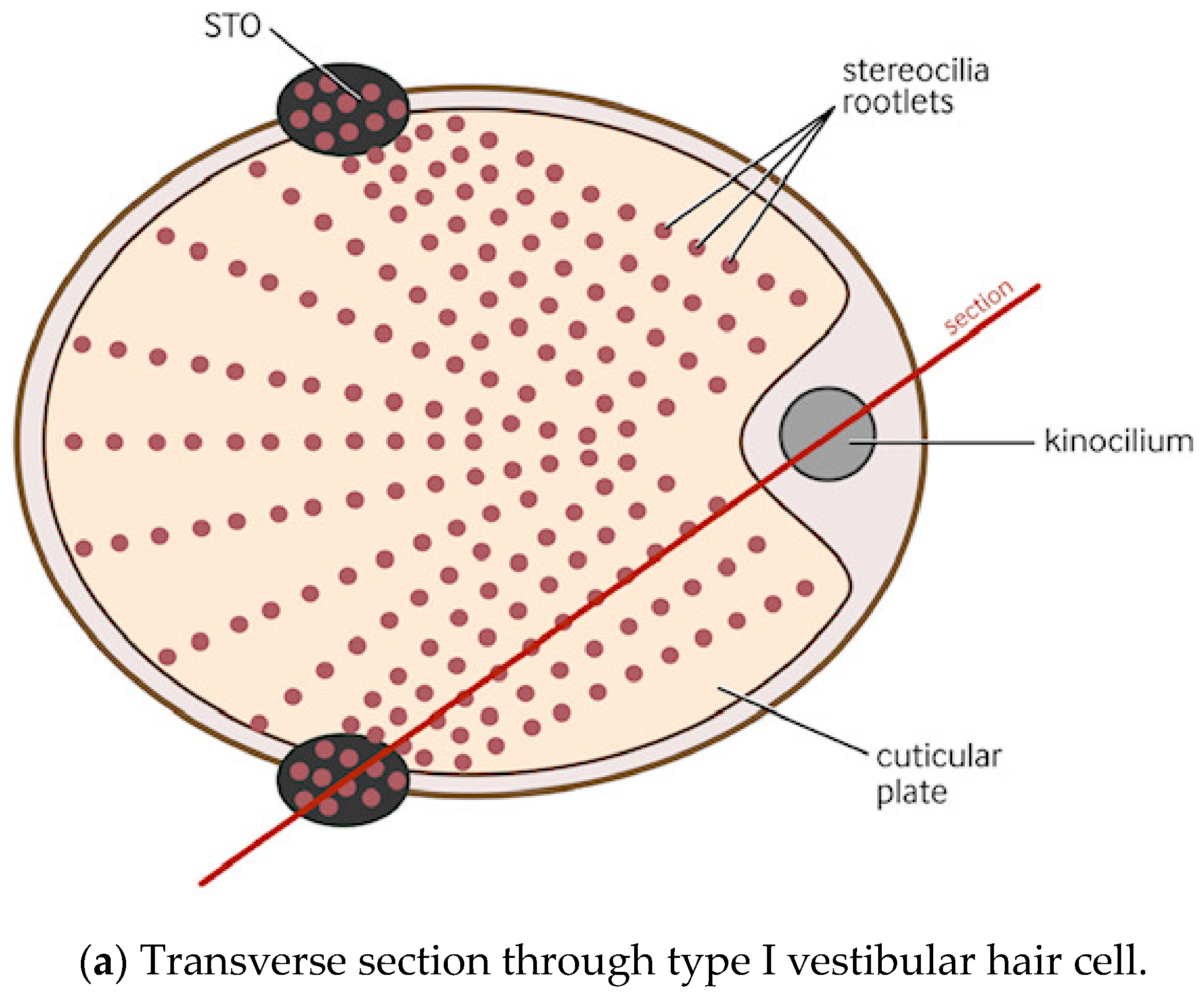 Audiolres 14 00044 g001a