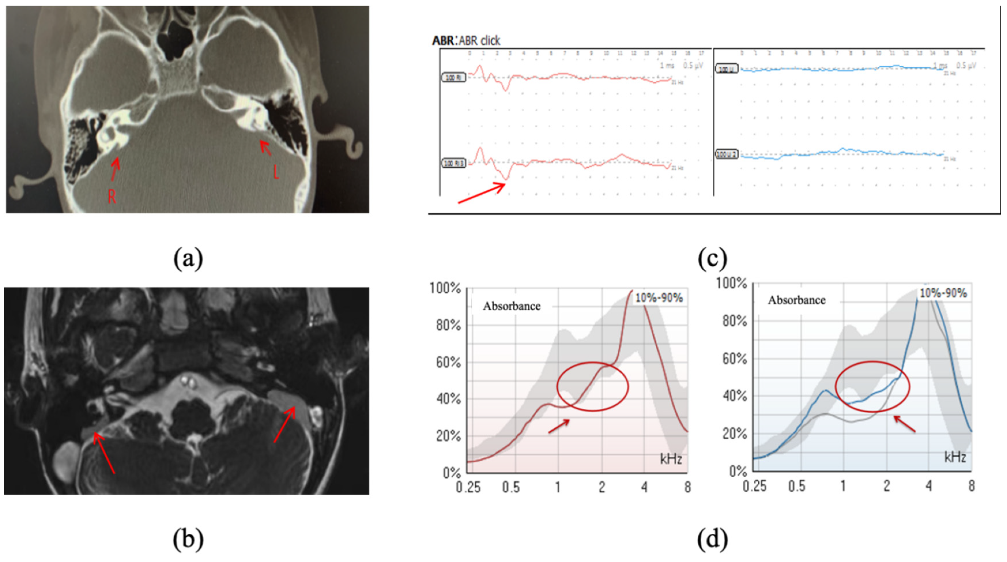 Audiolres 14 00058 g003 Audiolres 14 00058 g003