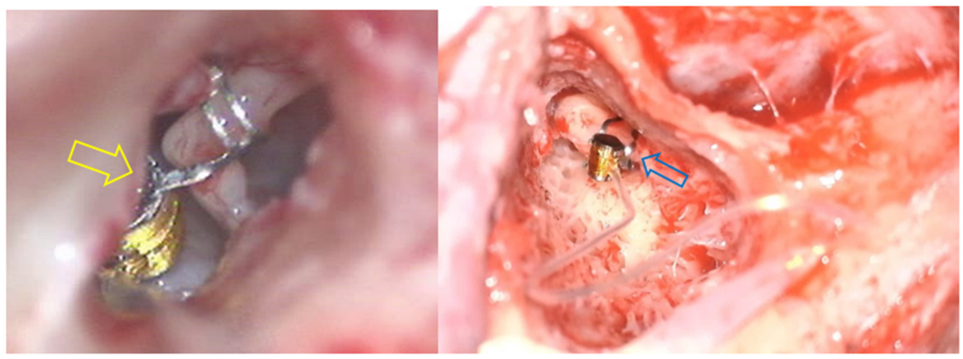 Audiolres 14 00061 g002