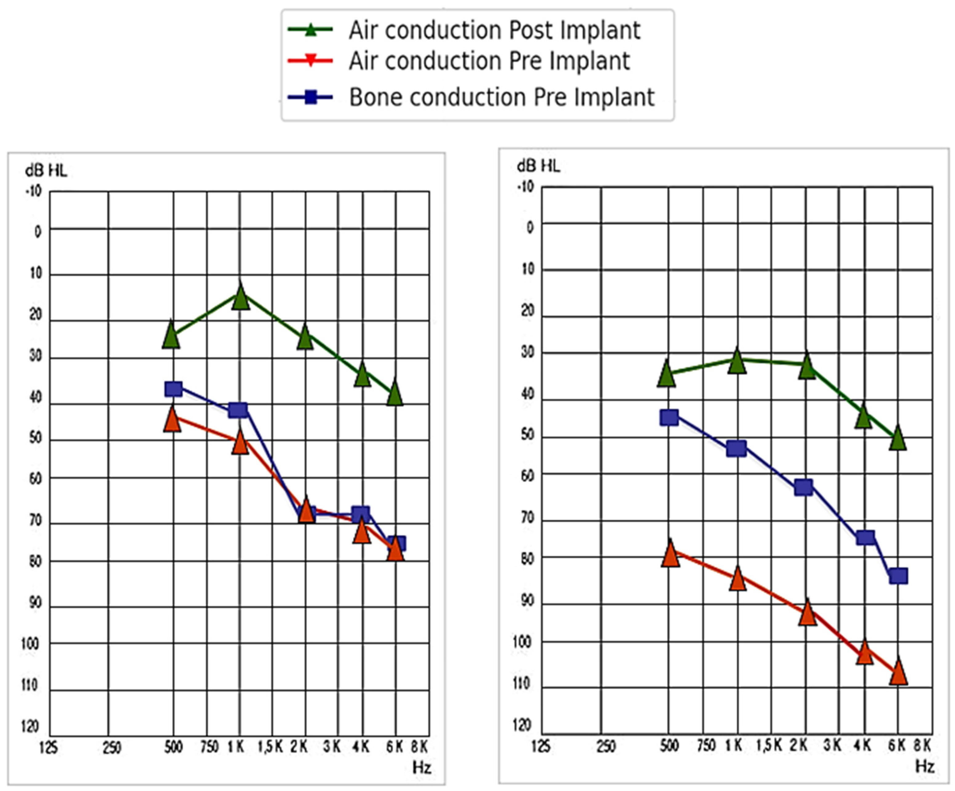 Audiolres 14 00061 g004