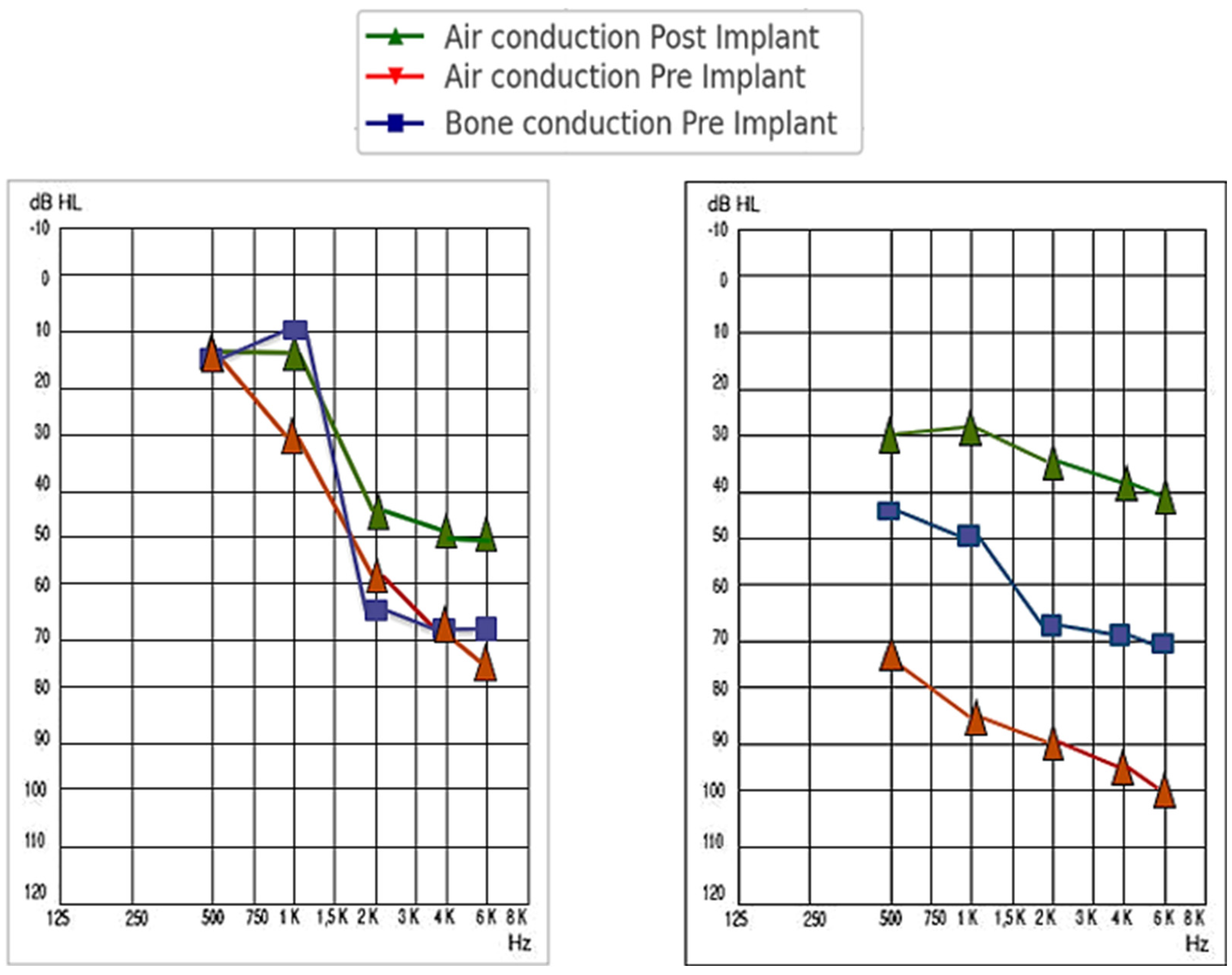 Audiolres 14 00061 g005