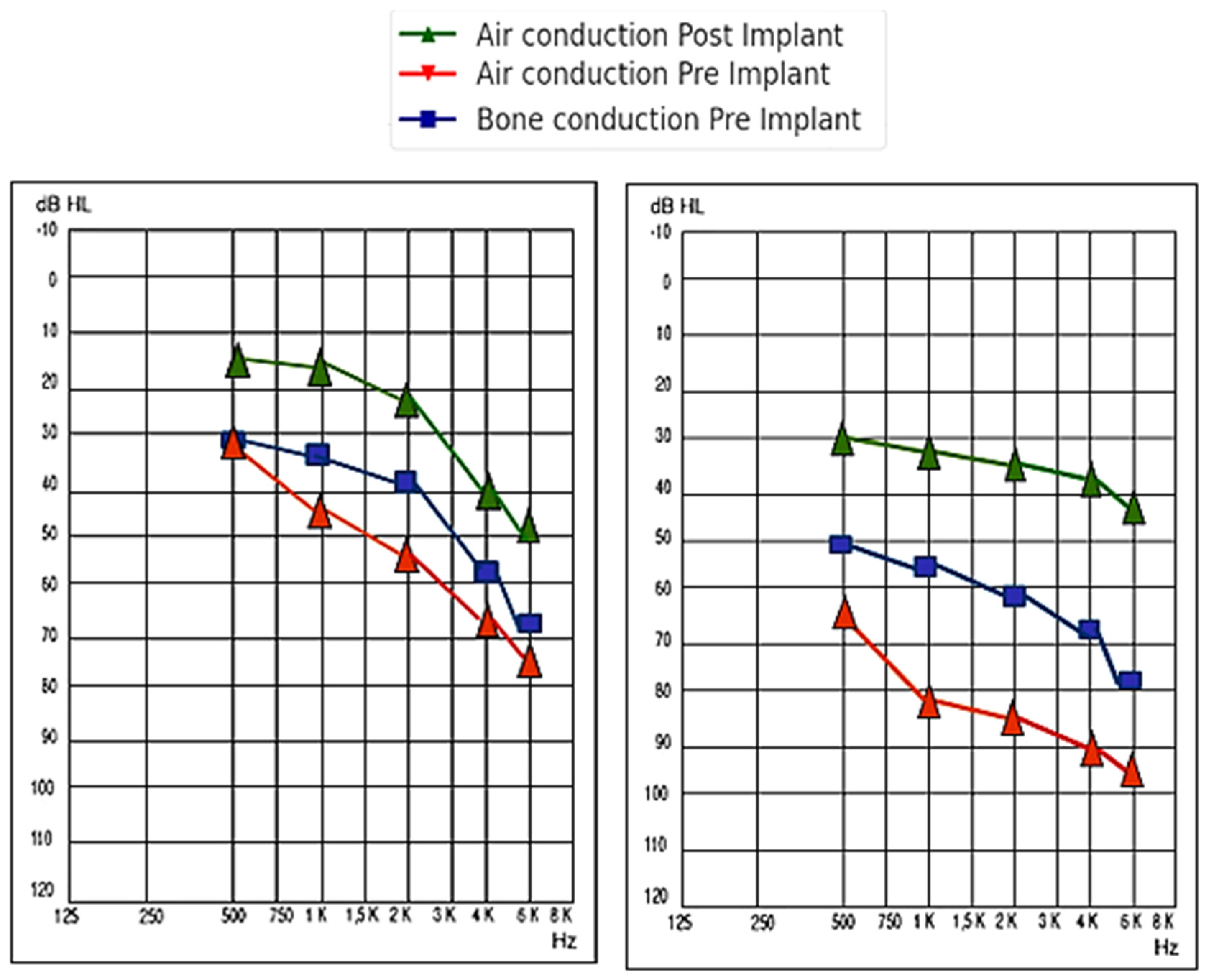 Audiolres 14 00061 g006
