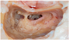 Audiolres 14 00061 i002