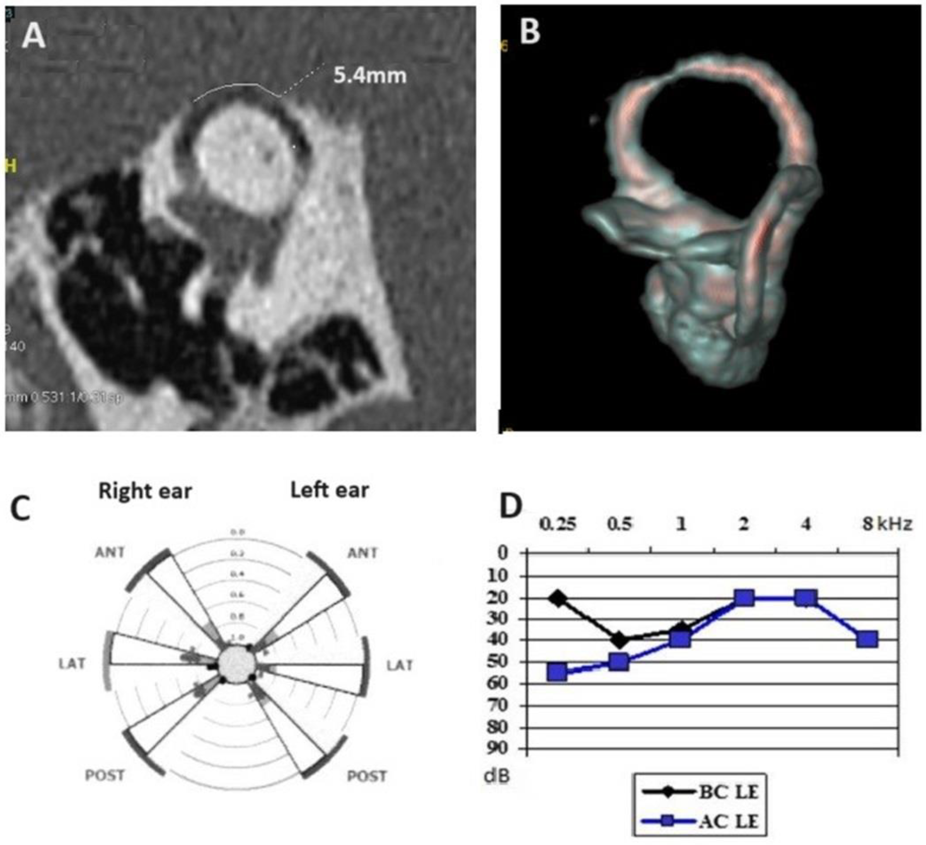 Audiolres 14 00072 g001