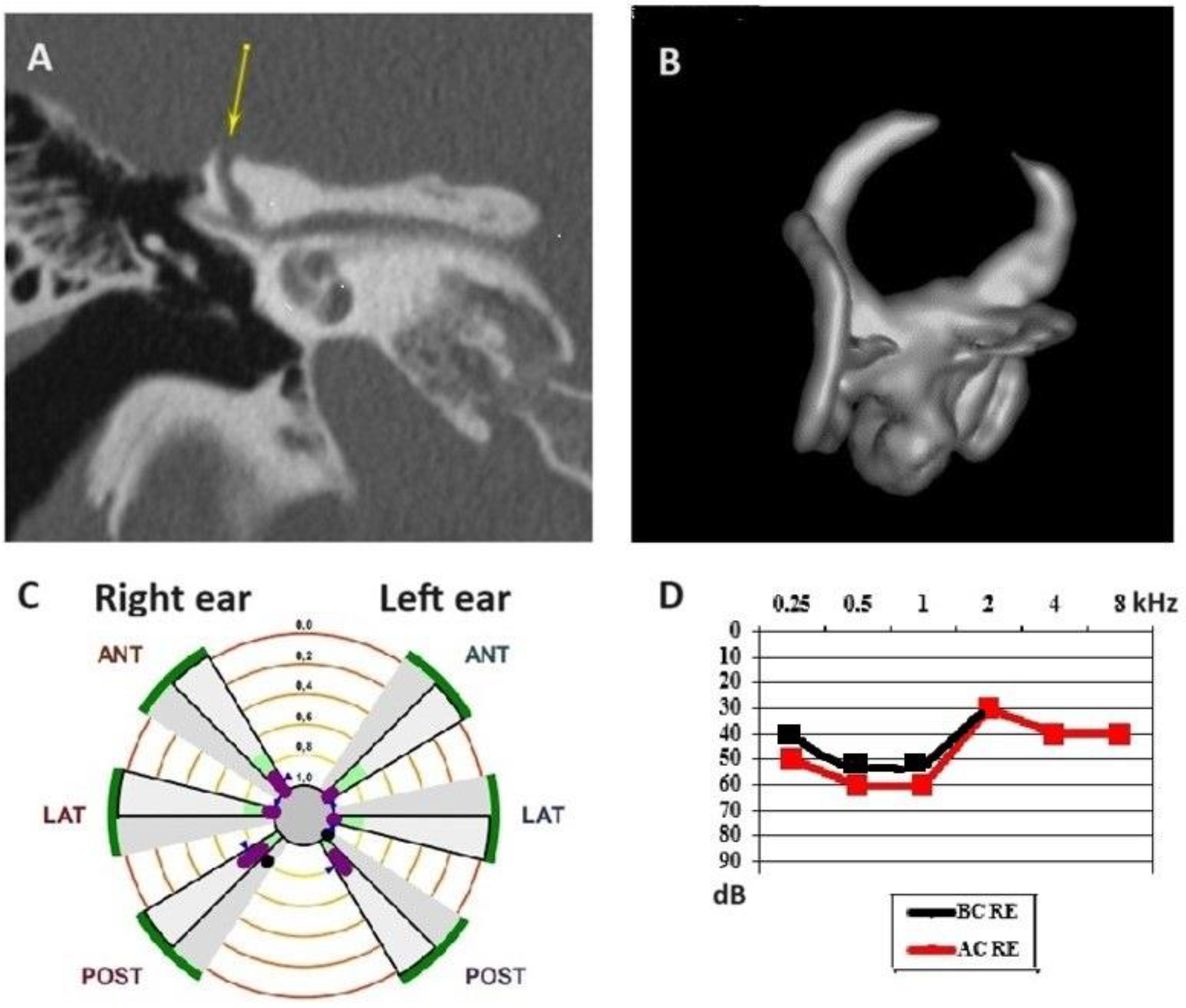 Audiolres 14 00072 g002