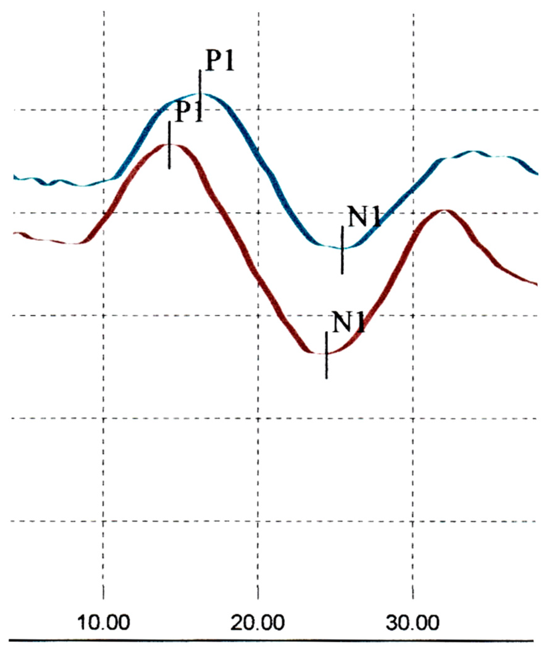 Audiolres 15 00018 g002