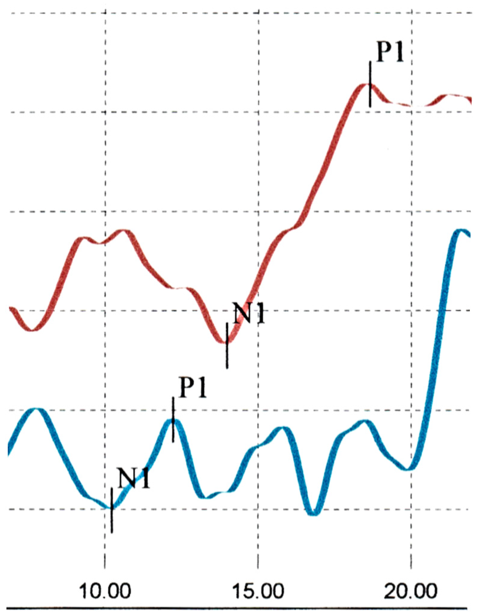 Audiolres 15 00018 g003