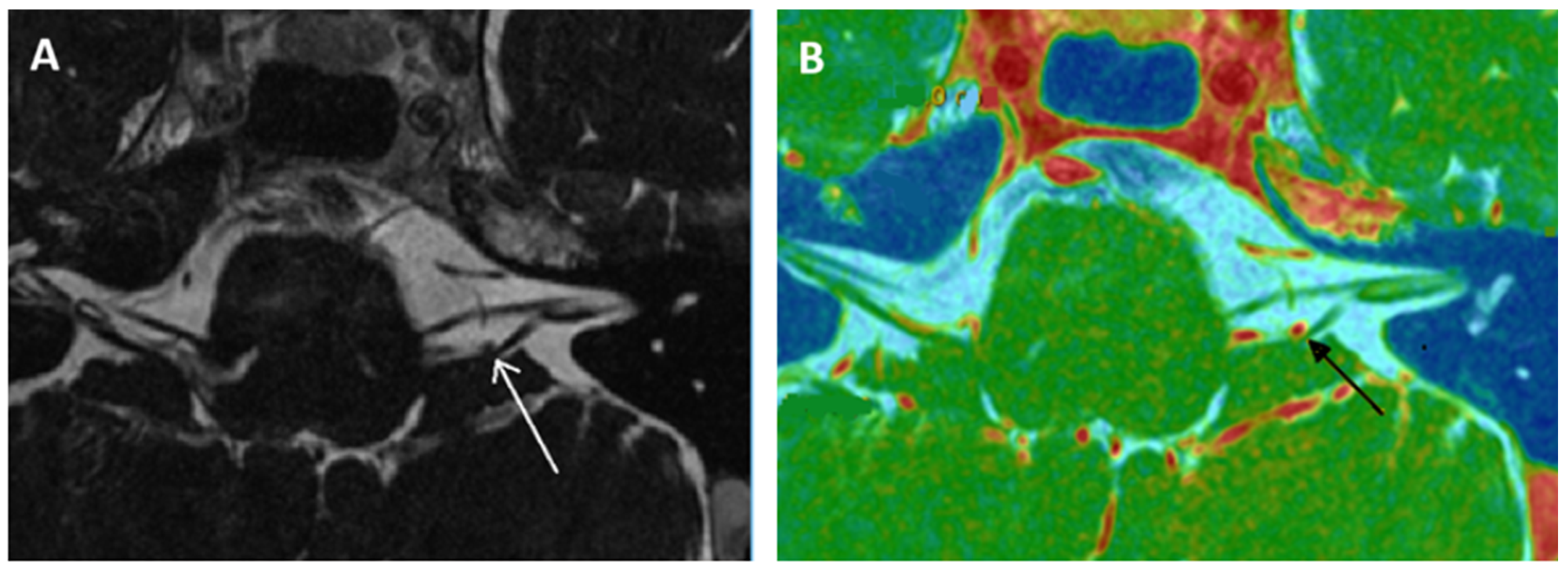 Audiolres 15 00028 g003 Audiolres 15 00028 g003